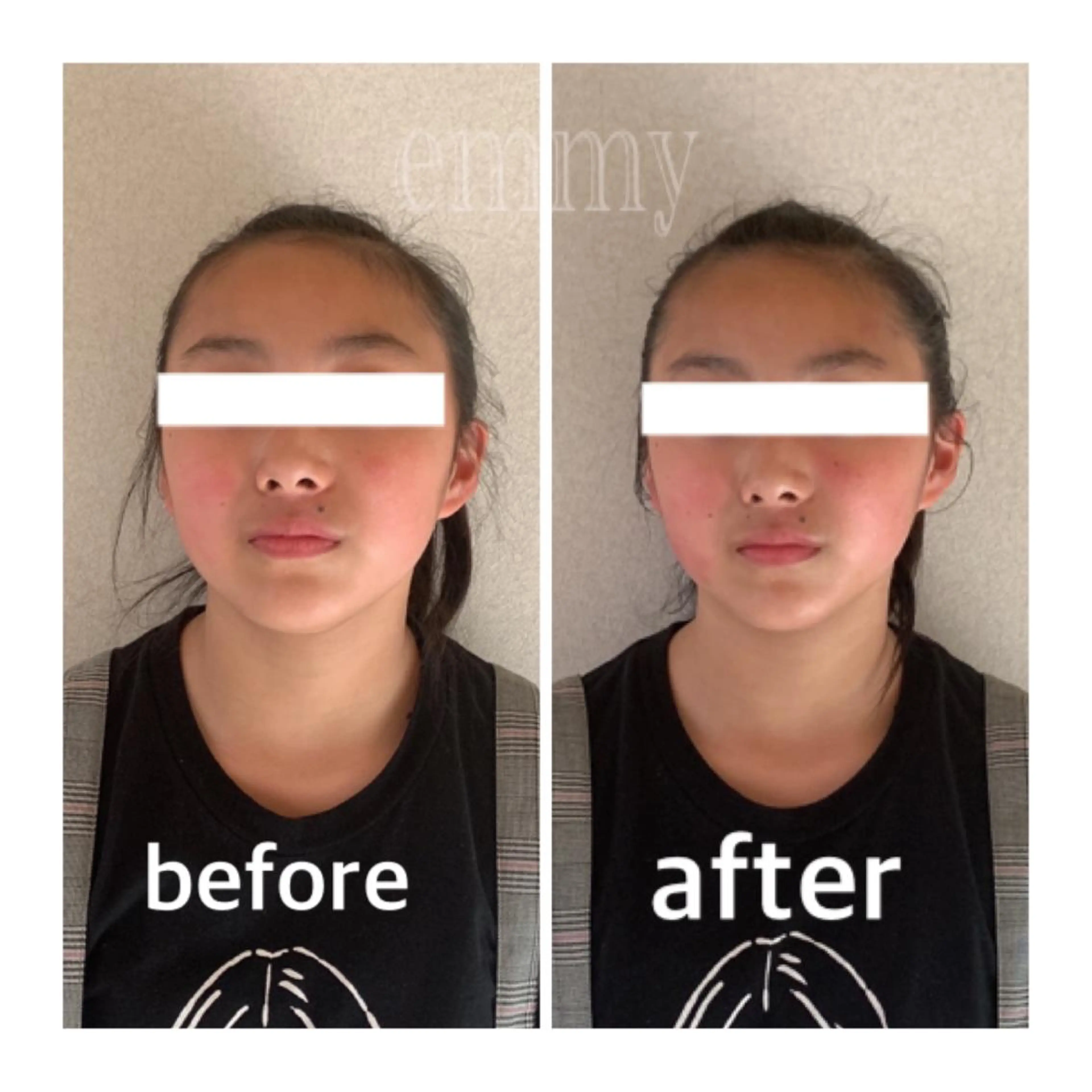 エステ リラク 小顔と ヘッドスパのお店のエステ・リラクイメージ