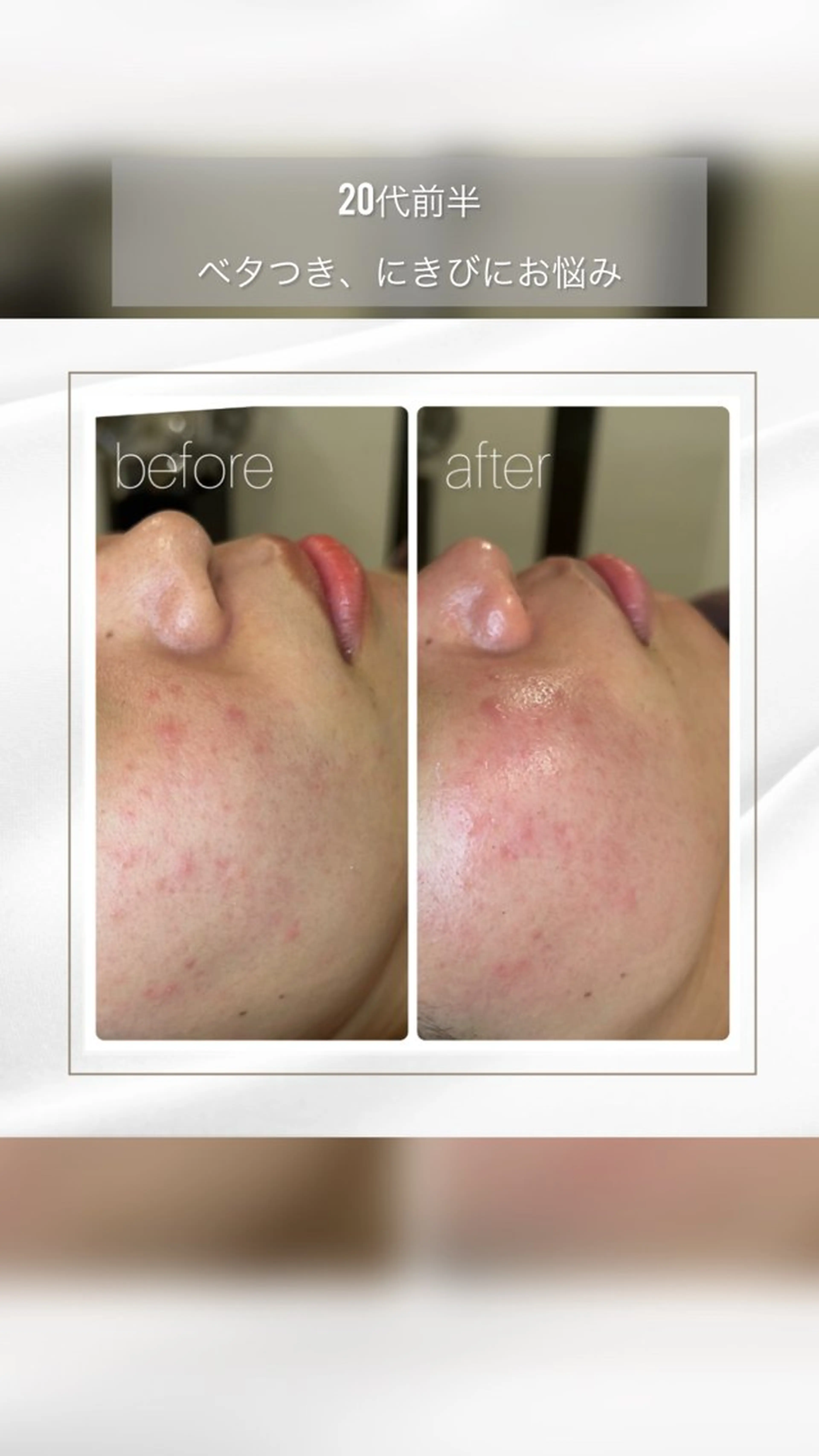 エステ BEAUTY SALON R's所属・BEAUTY SALON R'sのエステ・リラクイメージ