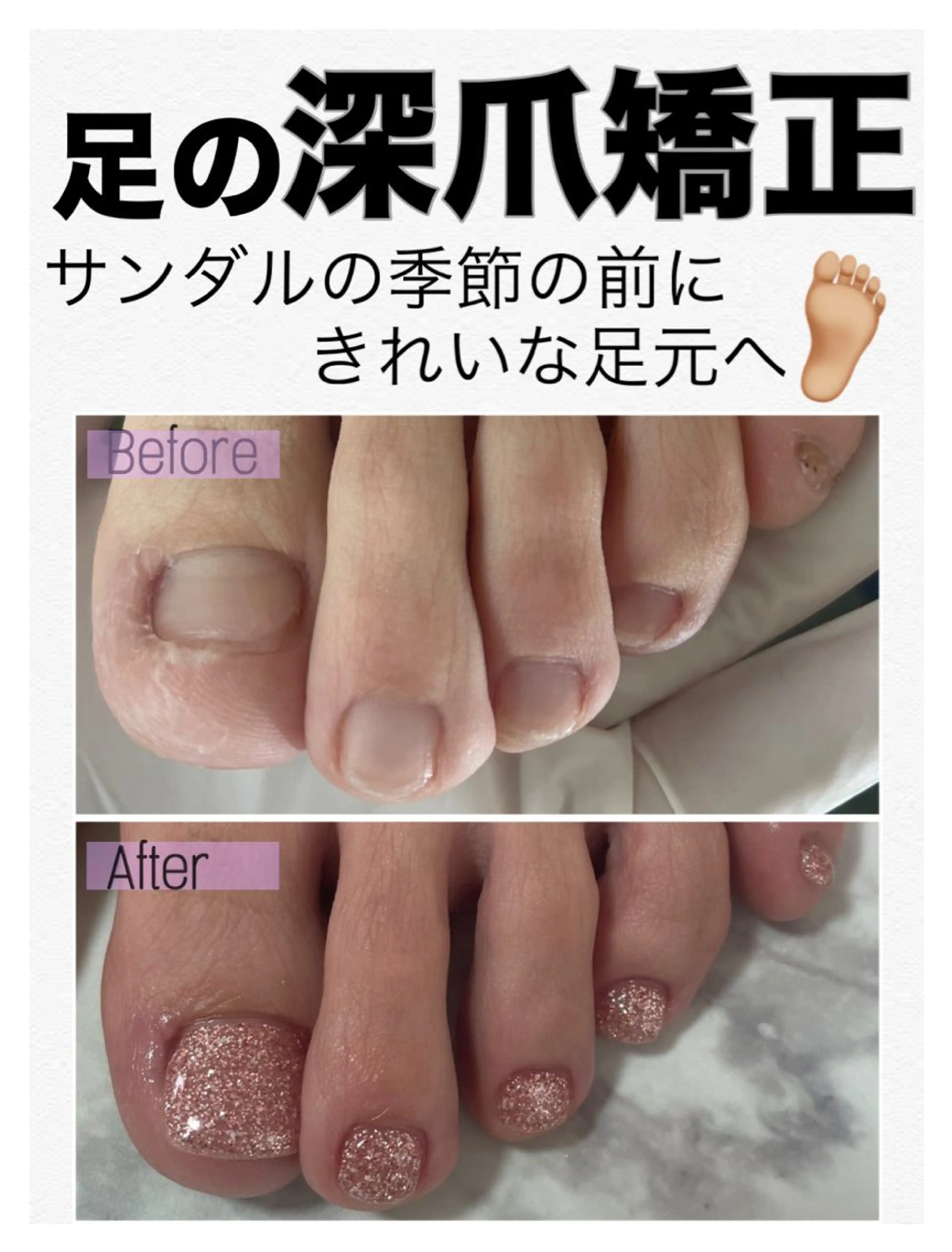 ネイル フットネイル フットネイル petillant所属・nail salon petillantのネイルデザイン