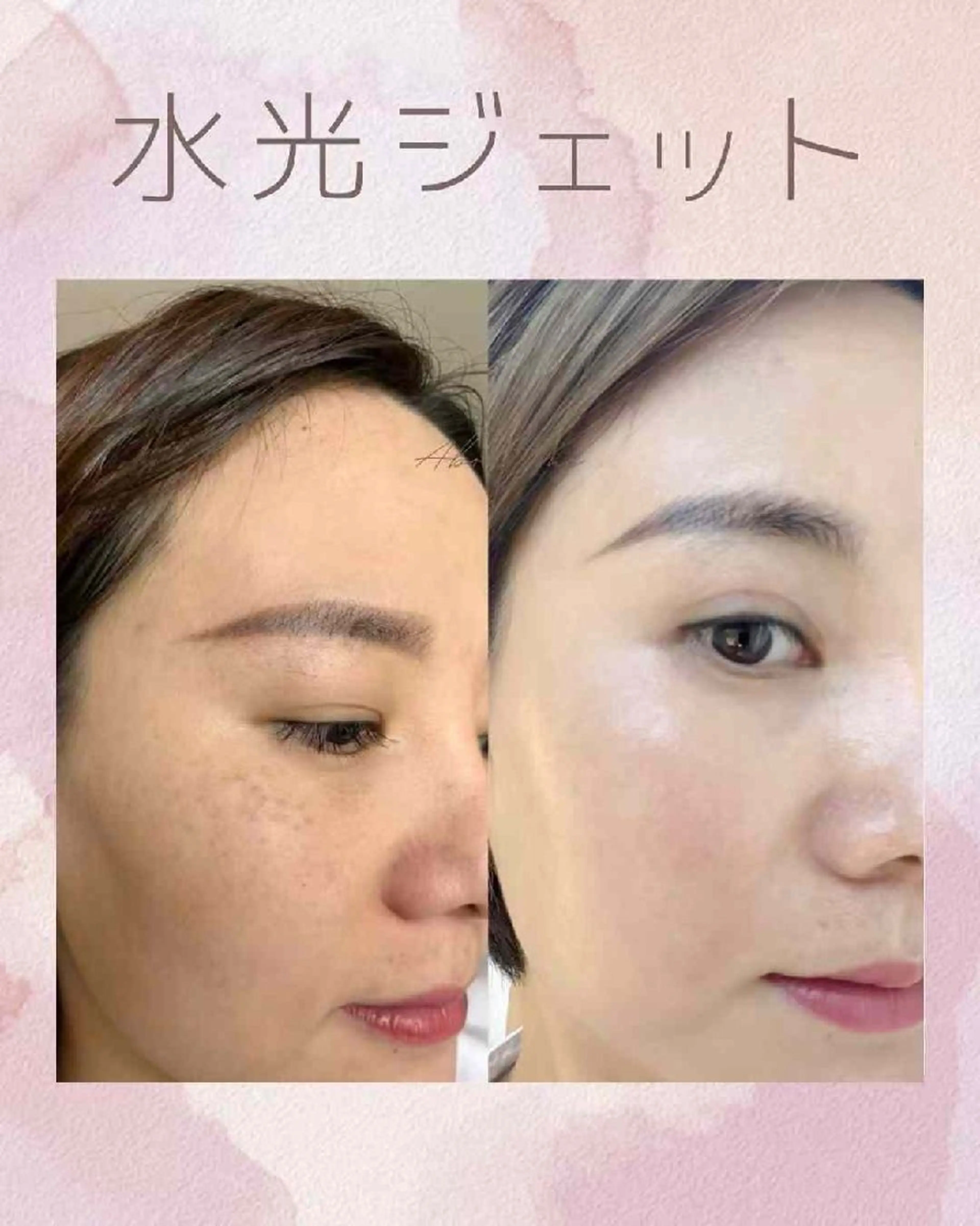 ネイル ブライダルネイル ホワイト aliaハイフ&水光ジェットサロン所属・aliaハーブ水光店 エステティシャン募集のエステ・リラクイメージ