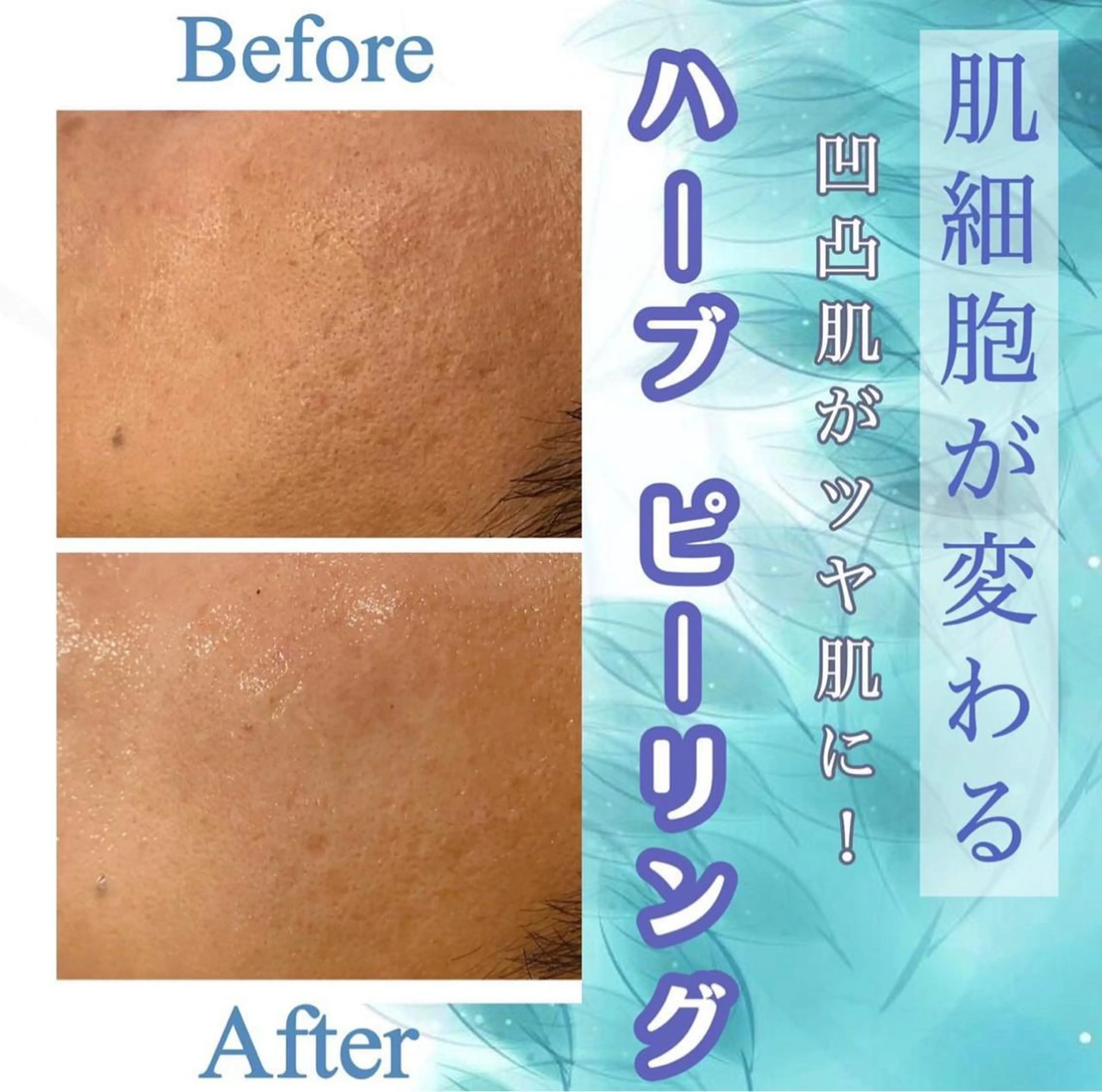 エステ Meow！～トラブル肌専門ピーリング＆脱毛サロン～所属・トラブル肌改善🏥 Meow！🫧🫧のエステ・リラクイメージ