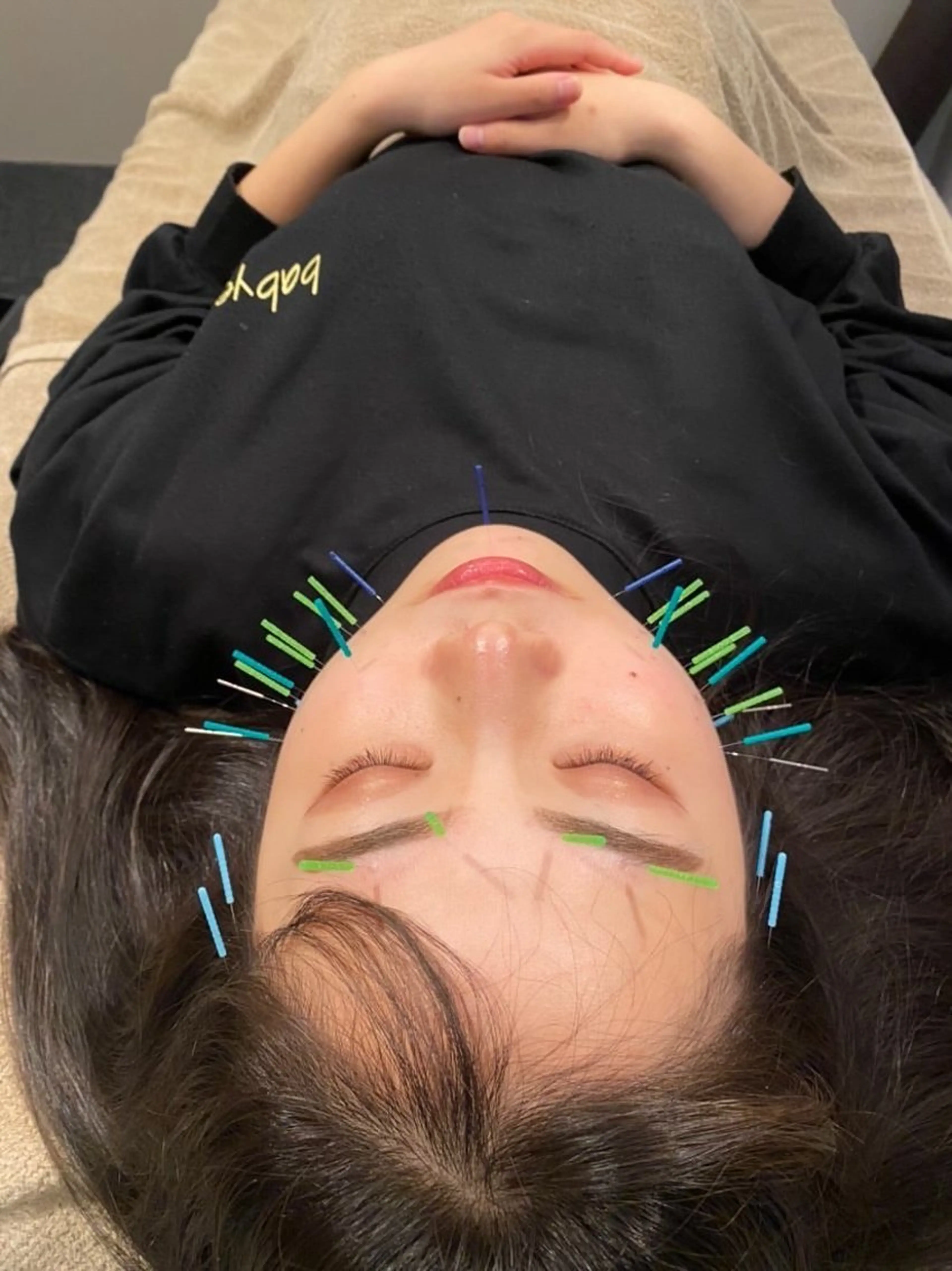 エステ リラク Body care salon LUANA所属・小顔・整体・美容鍼 ・脱毛/LUANAのその他イメージ