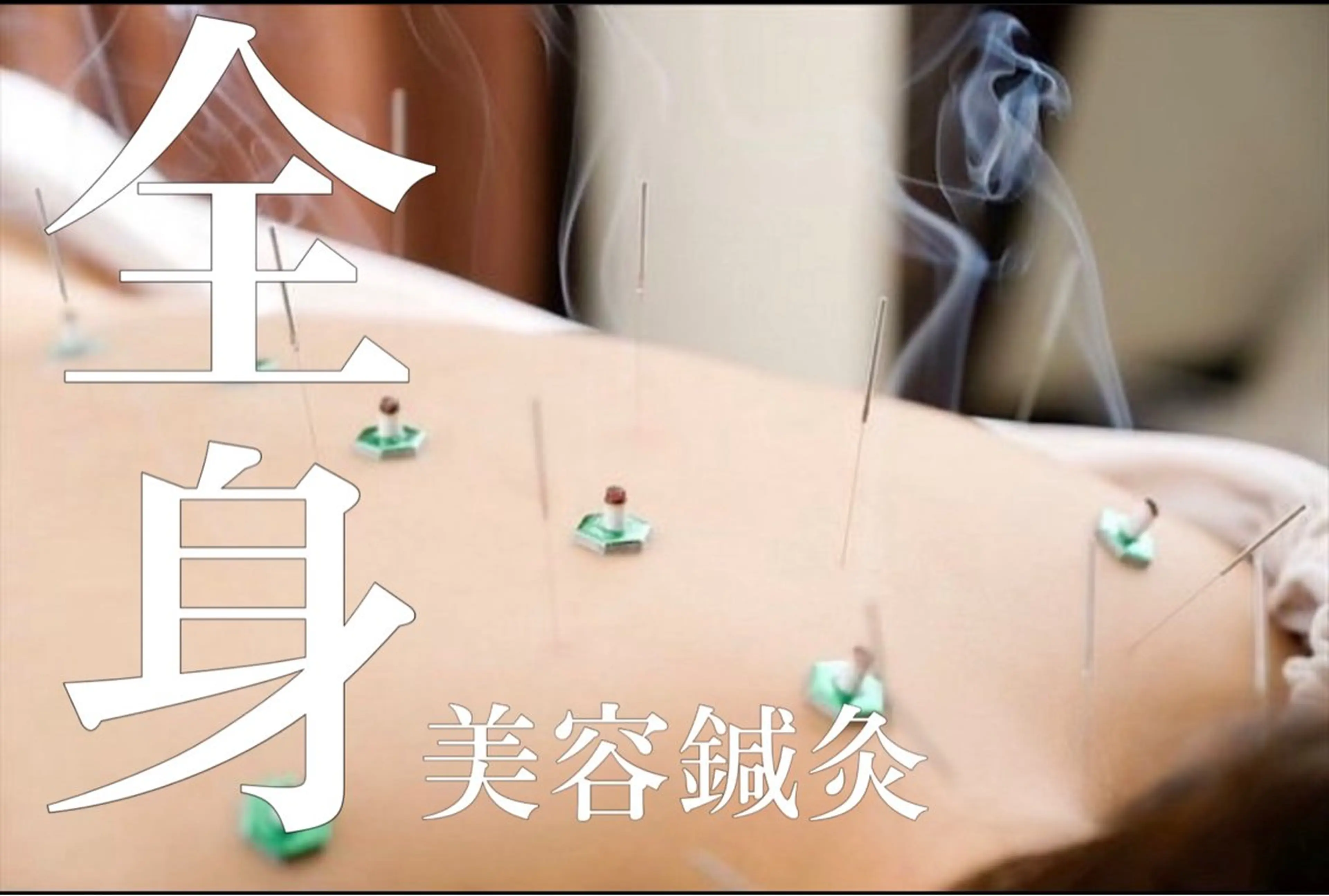 【贅沢の極み】 当店人気No.1メニュー❣️驚く贅沢😍頭から全身トータルケア美容鍼/美容鍼灸90分の写真