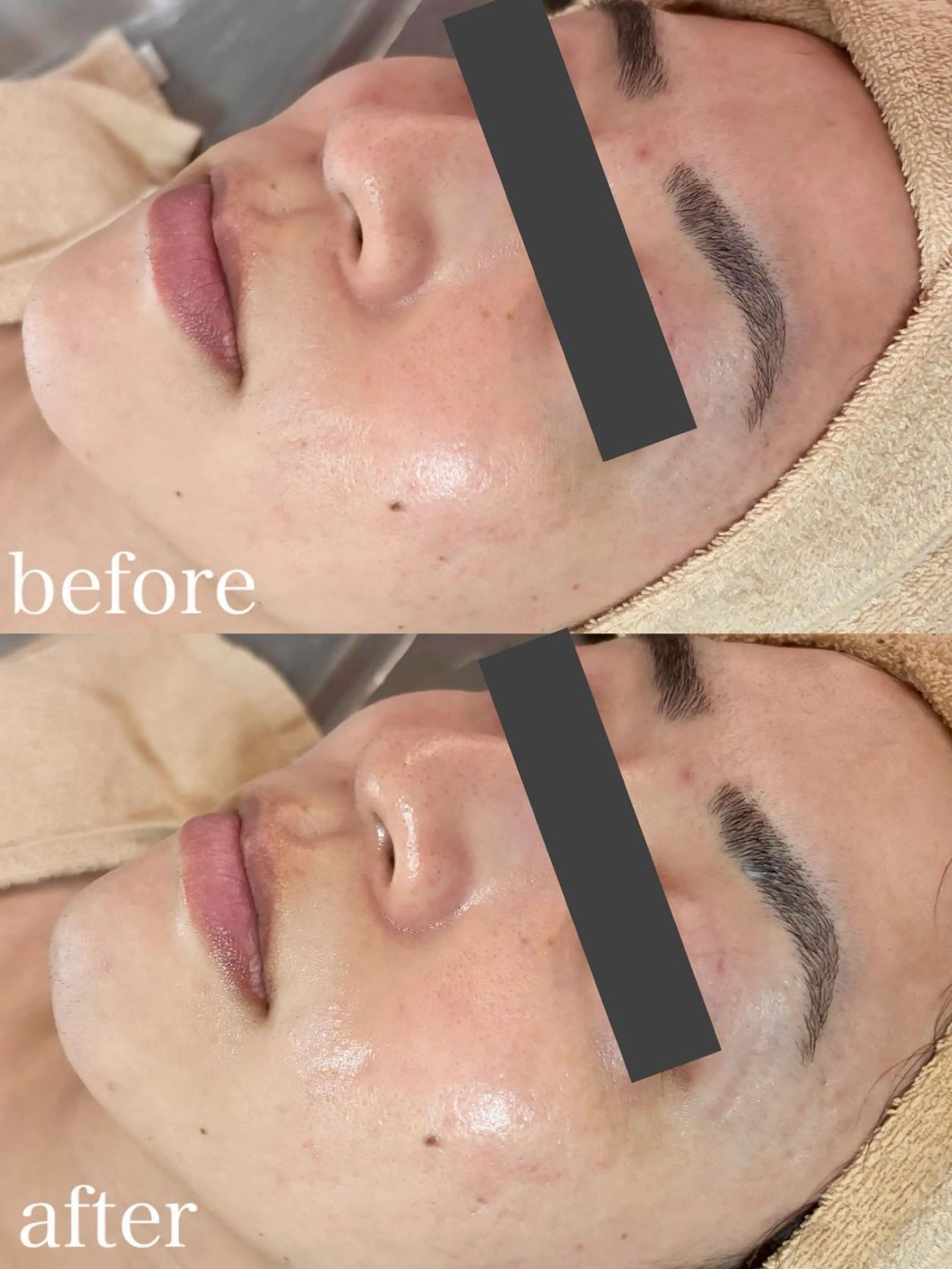 エステ WHITE AQUA 北千住店のエステ・リラクイメージ