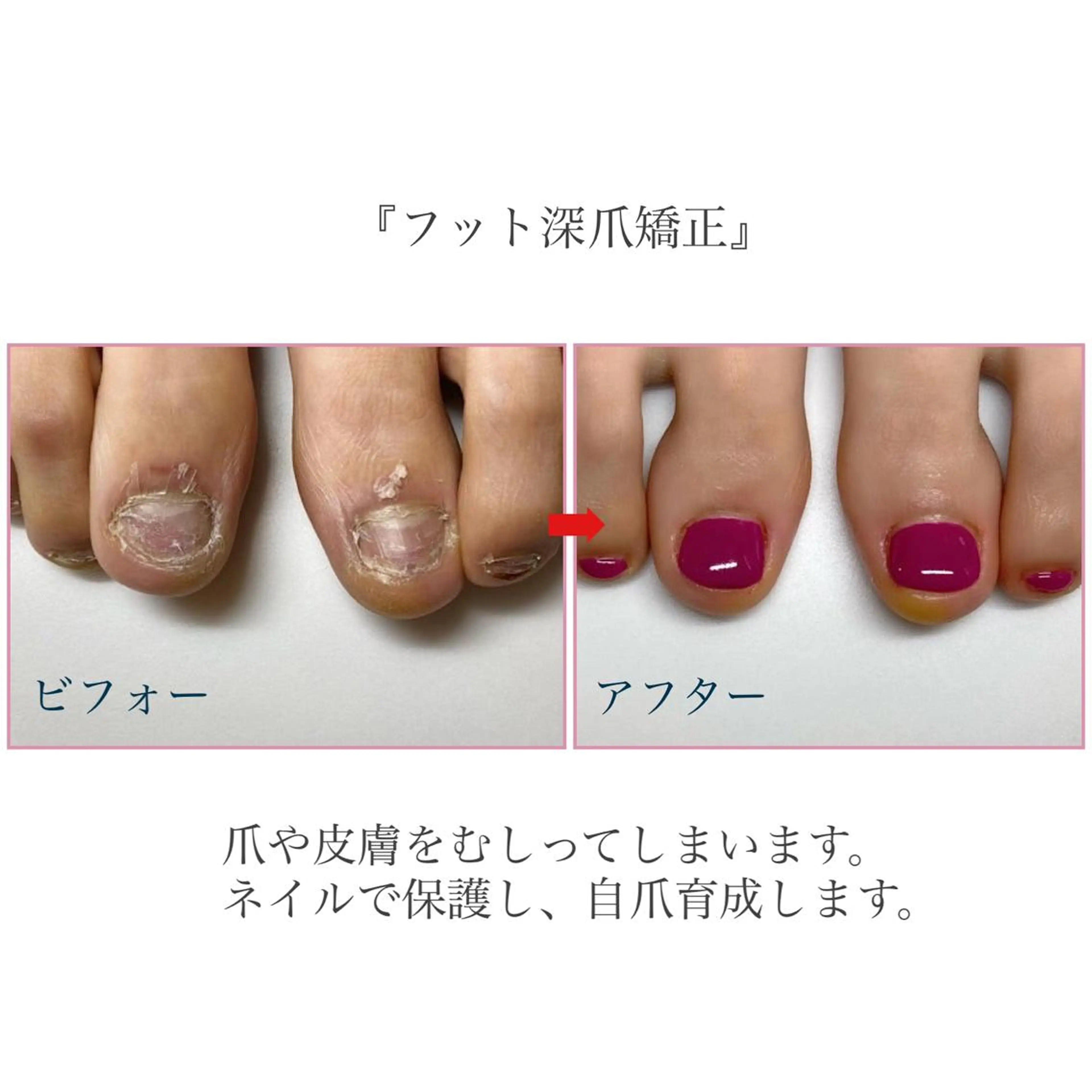 ネイル フットネイル ネイルサロンアリューム所属・ネイルサロン アリュームのネイルデザイン