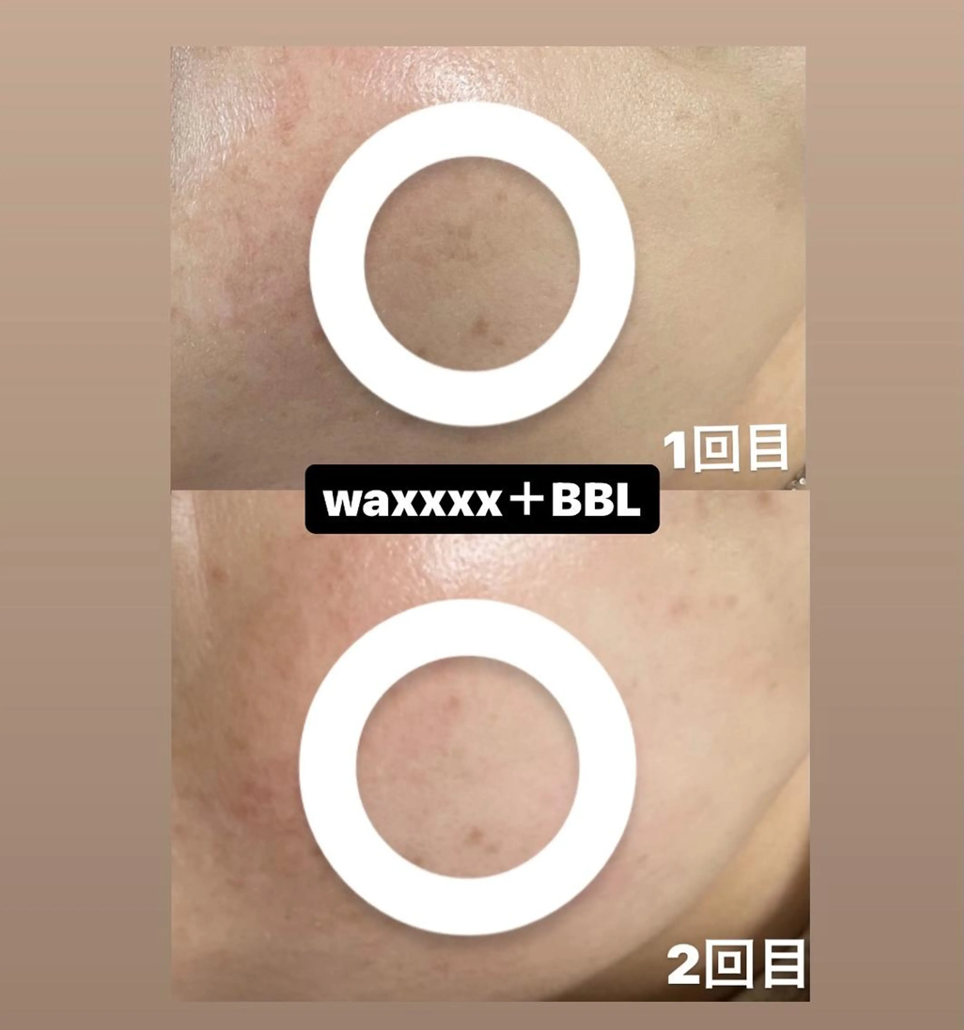 脱毛 Epina 千葉店 【エピナ】のエステ・リラクイメージ