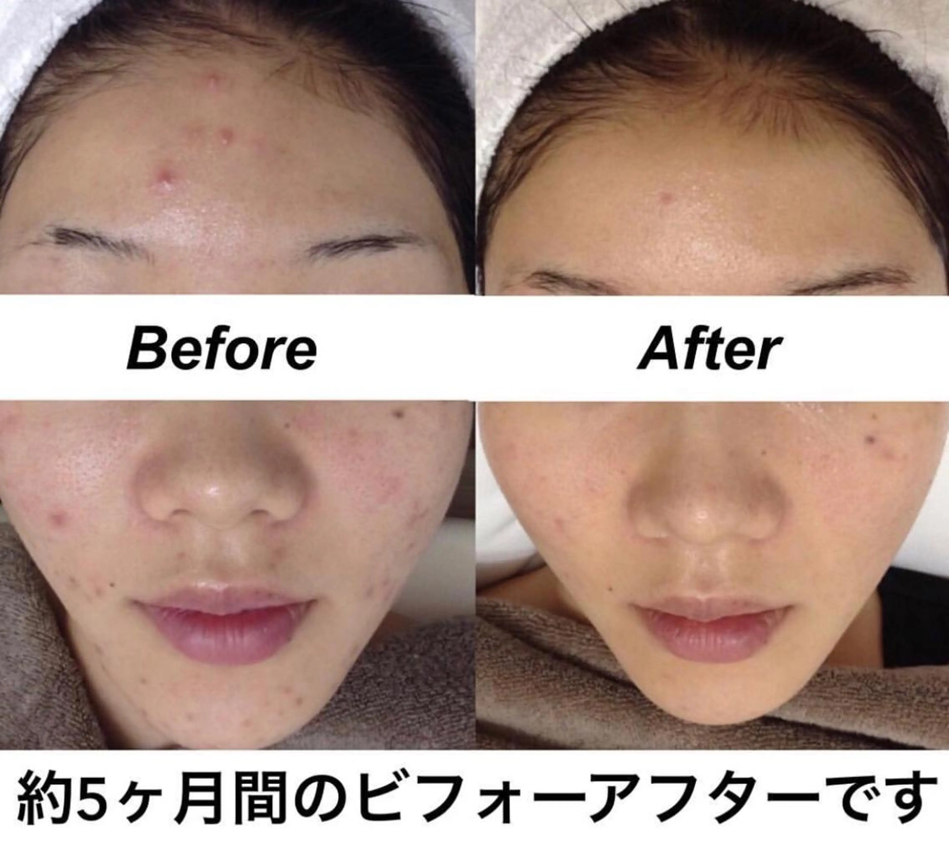 エステ リラク 都度払い肌質改善 &脱毛Blancheのエステ・リラクイメージ