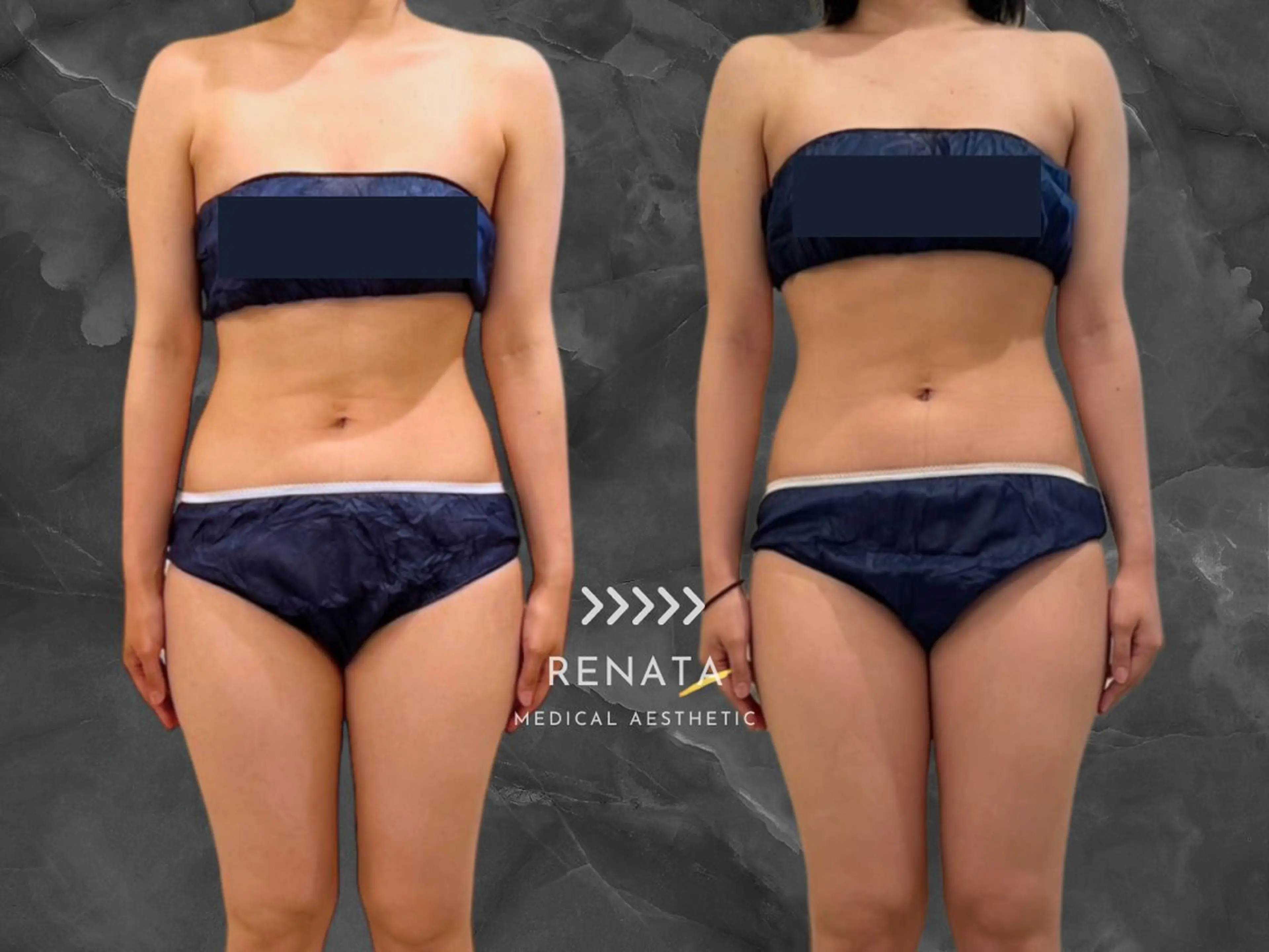 RENATA🕊 脂肪冷却専門店六本木のエステ・リラクイメージ