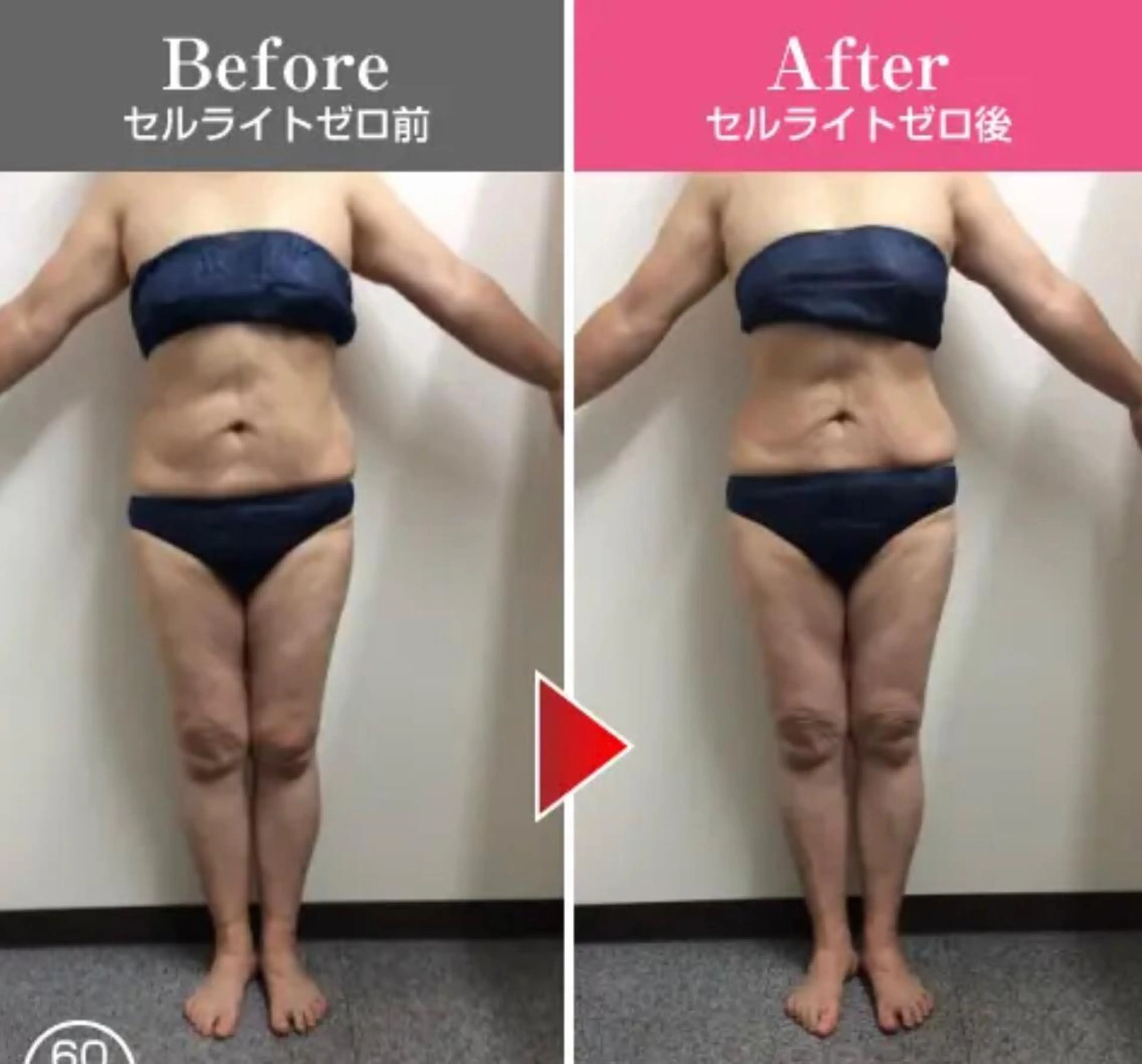 切らない脂肪吸引🔥 Neroliまりこのエステ・リラクイメージ