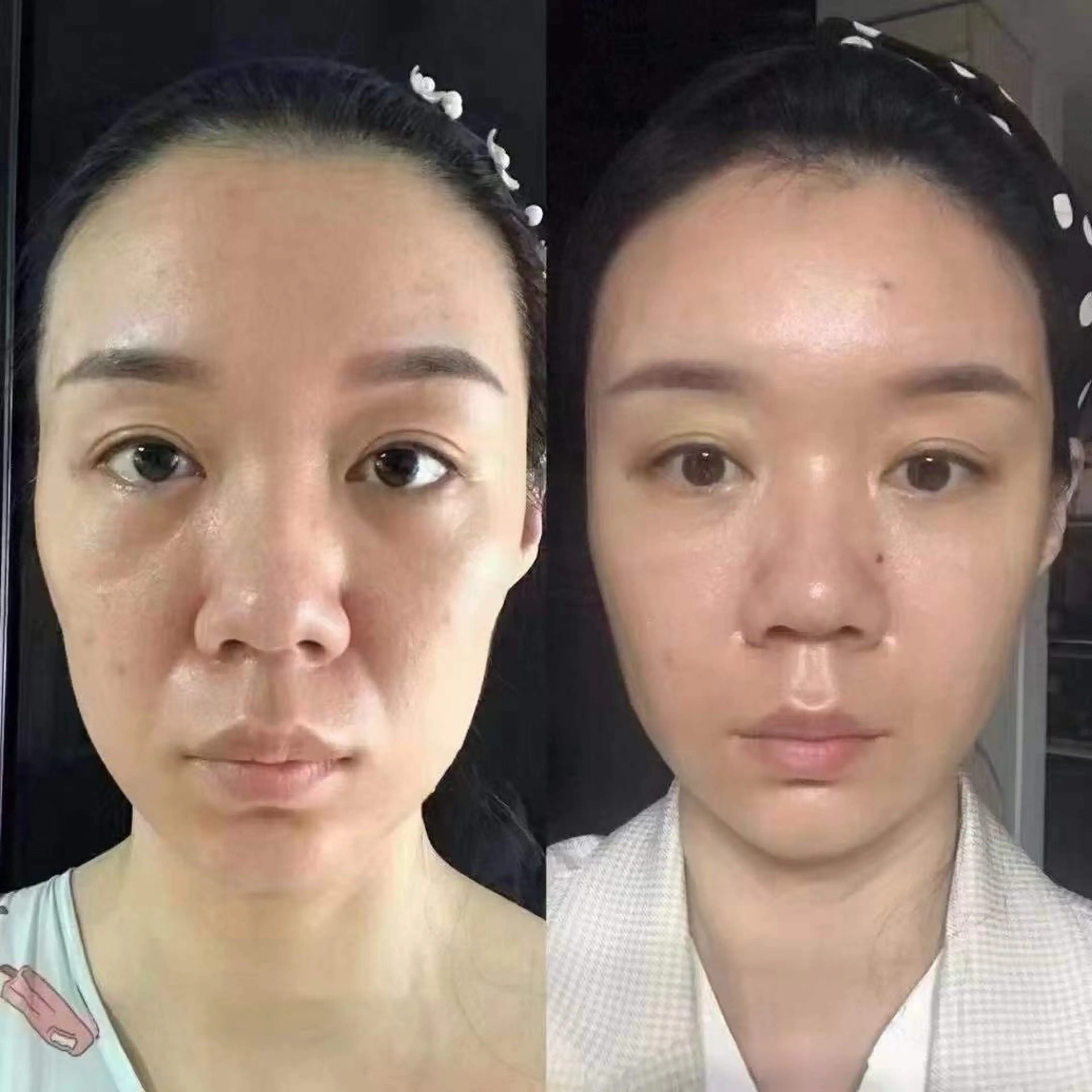 ネイル エステ aliaハイフ&水光ジェットサロン所属・aliaハーブ水光店 エステティシャン募集のエステ・リラクイメージ