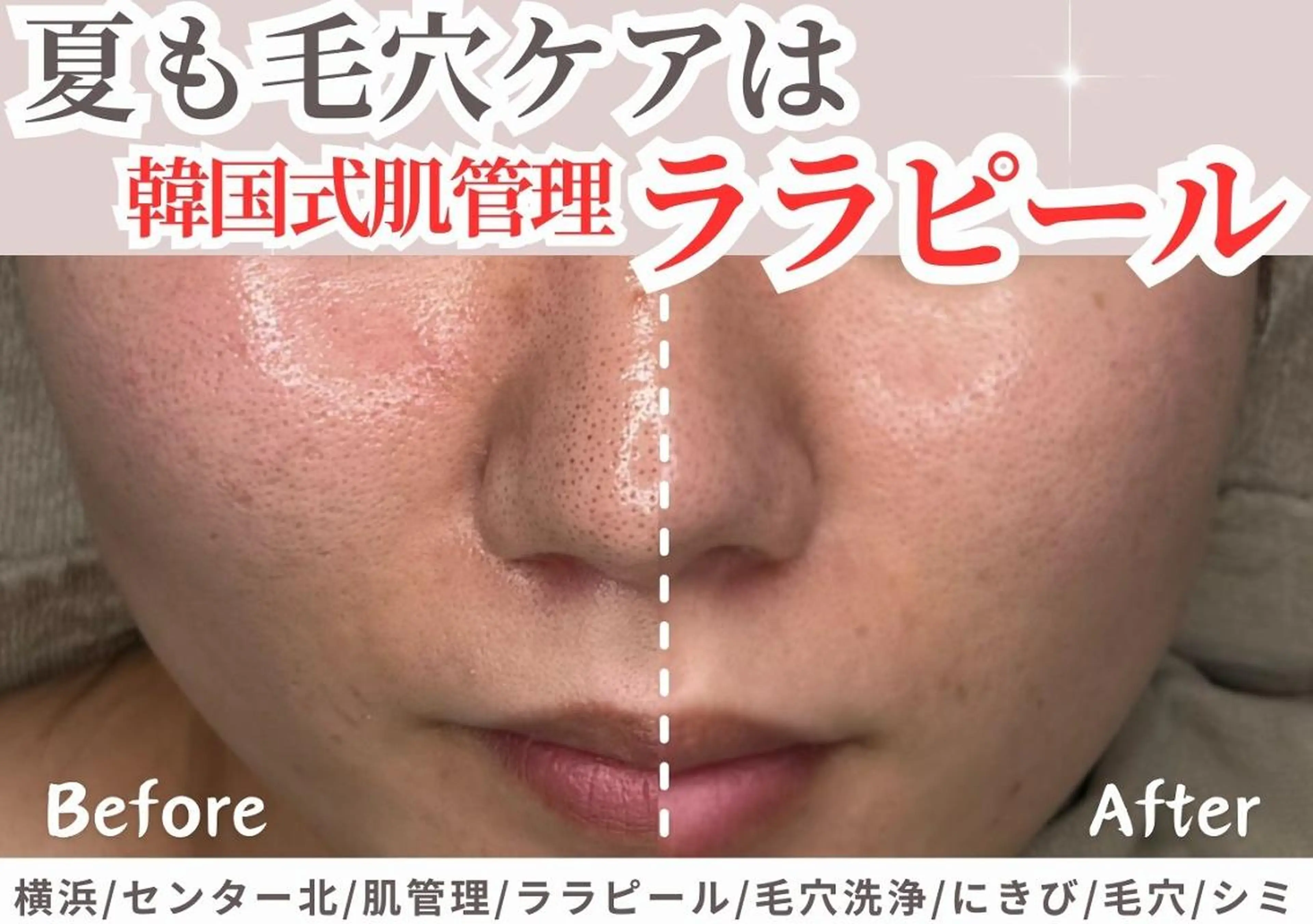 エステ sii センター北 AIのエステ・リラクイメージ