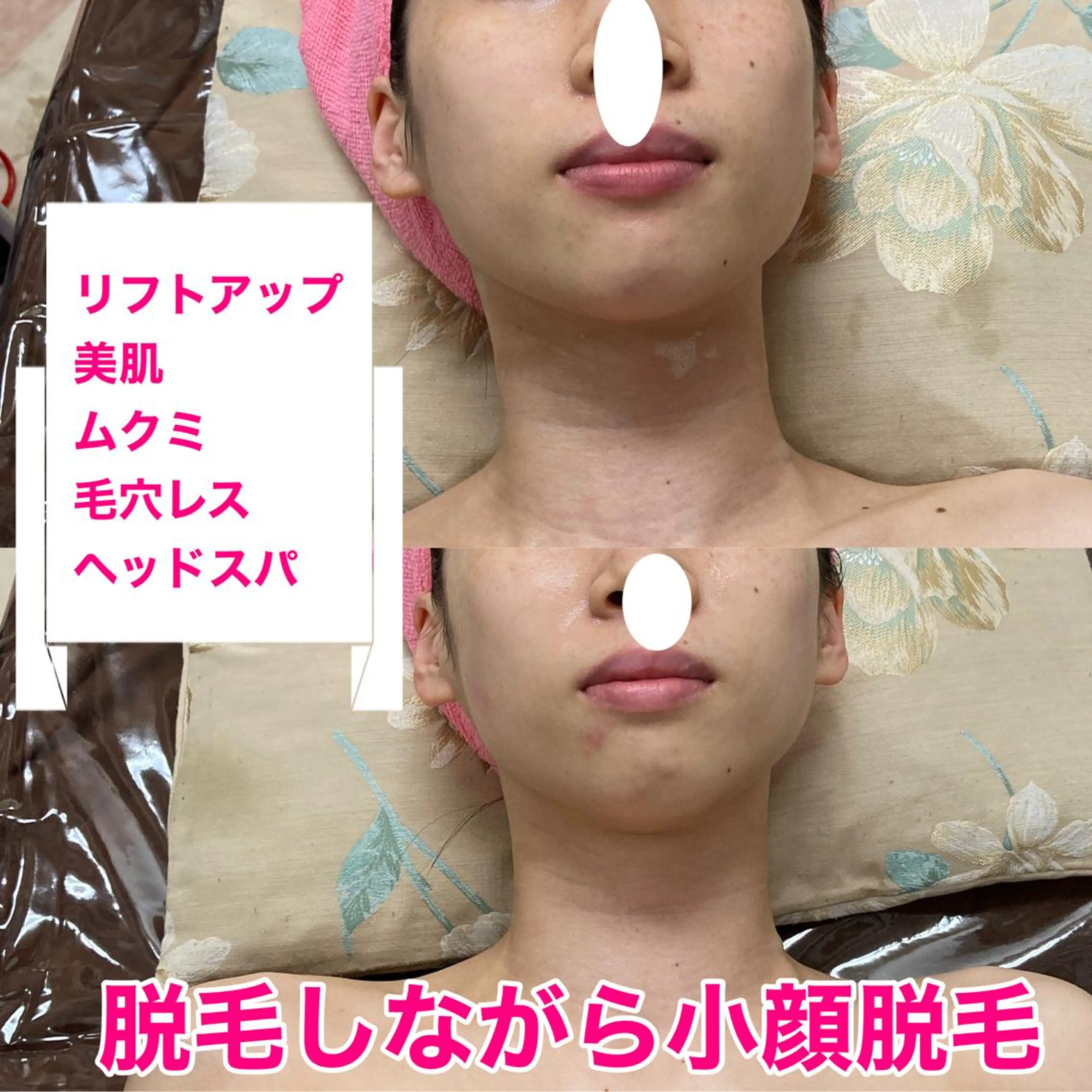 オアシス・さくら所属・中村貴子都度払い脱毛 小顔コルギのエステ・リラクイメージ