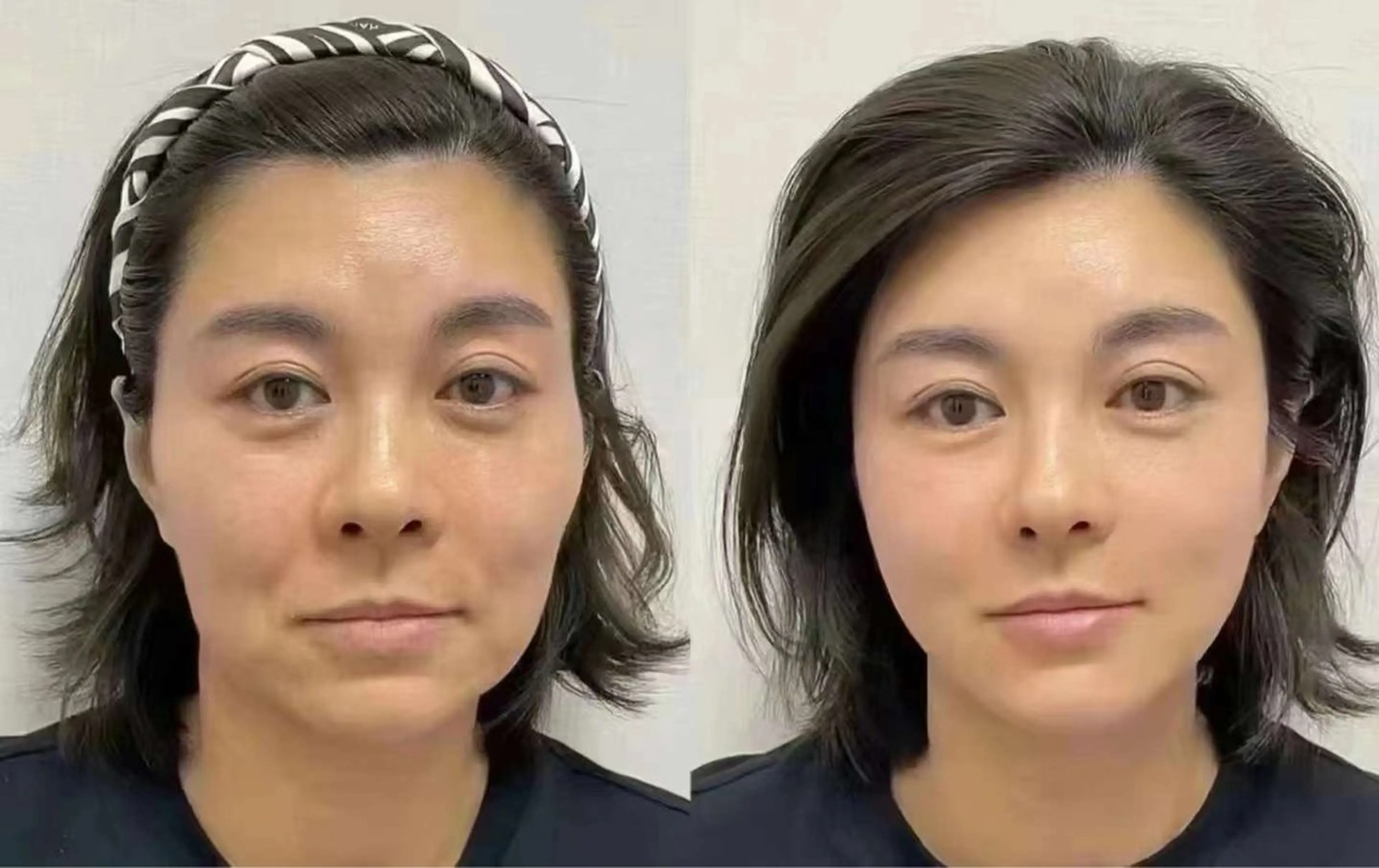 ネイル エステ aliaハイフ&水光ジェットサロン所属・aliaハーブ水光店 エステティシャン募集のエステ・リラクイメージ