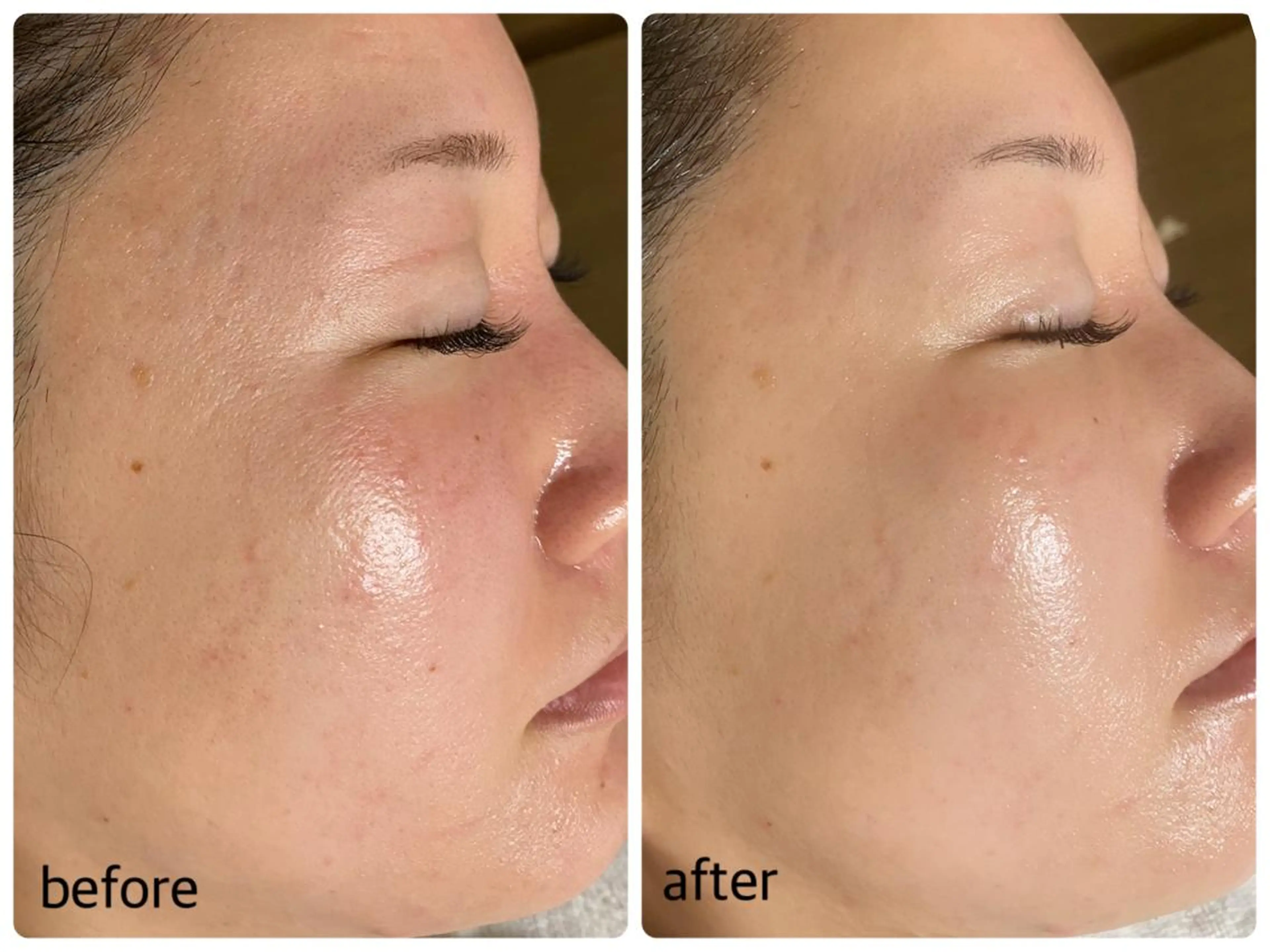 その他 エル美容室所属・oshima yuukiのマツエク・マツパデザイン