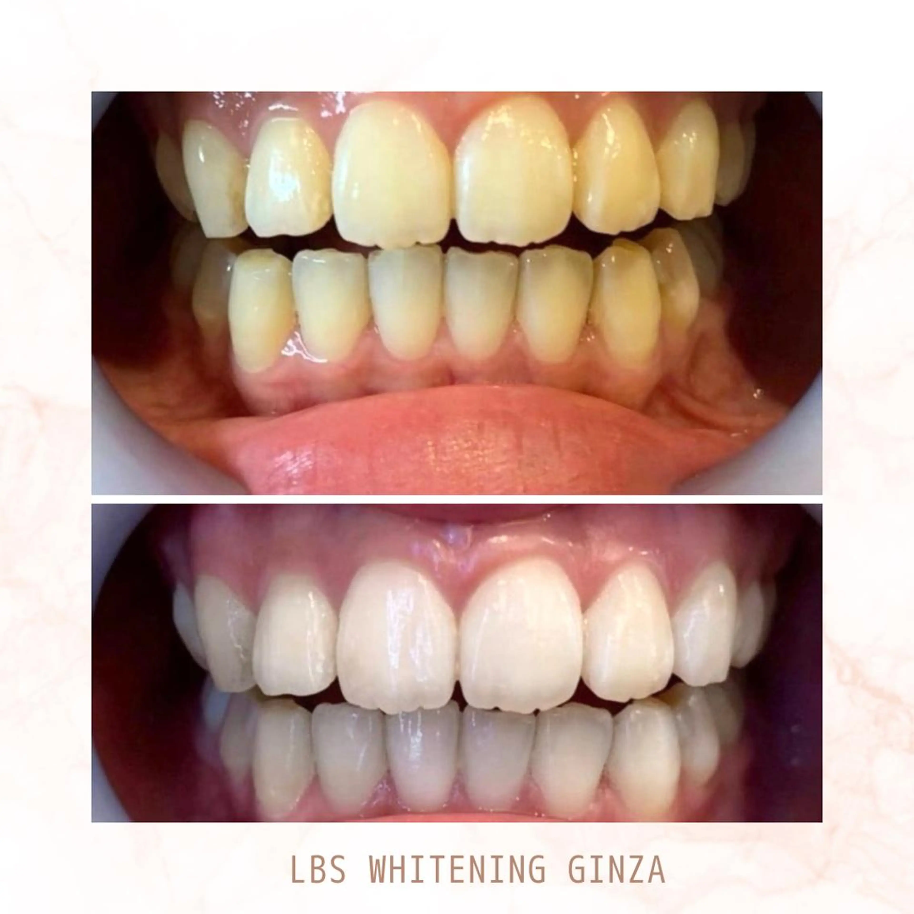 メンズ エステ リラク LBSホワイトニング 銀座店💎店長浦和のその他イメージ