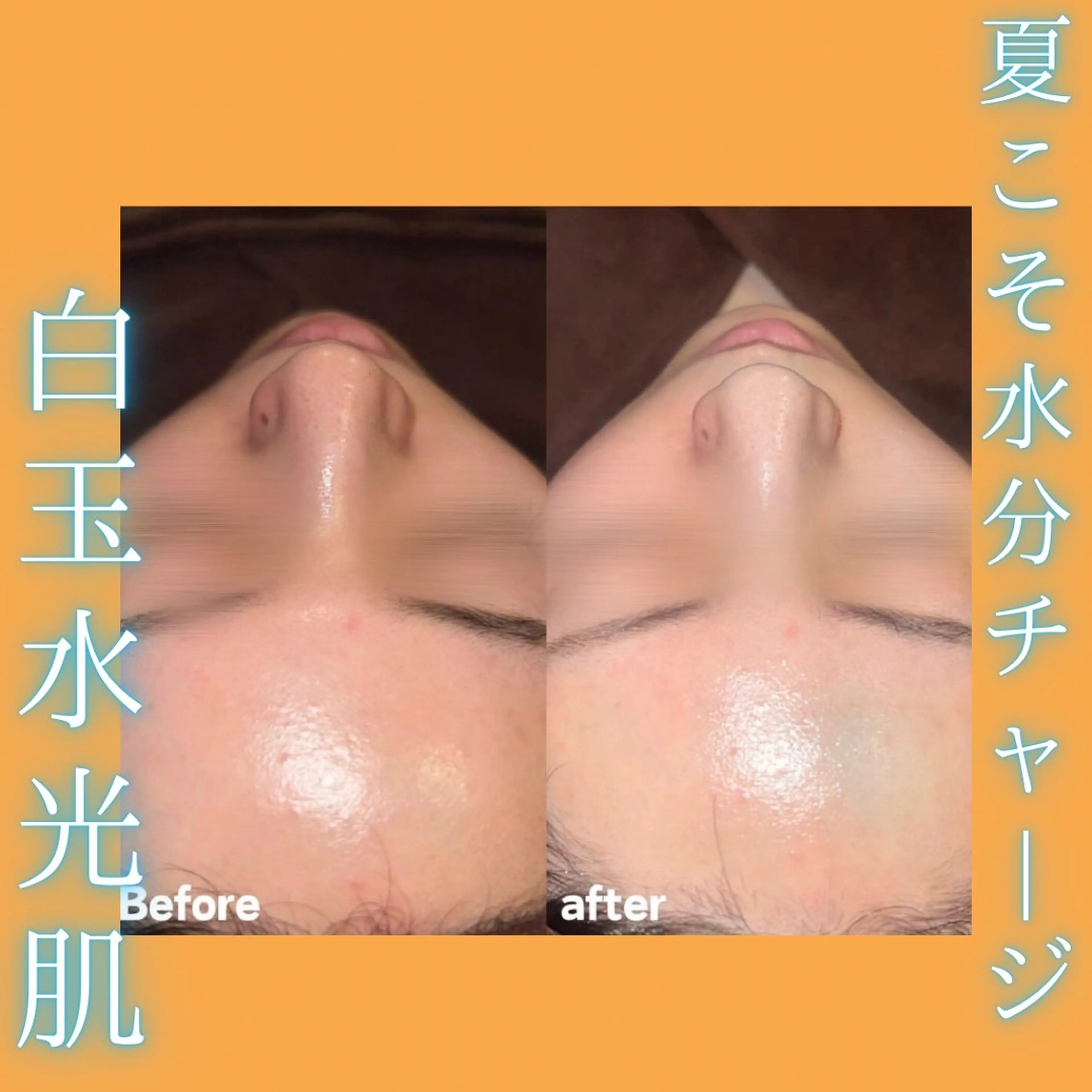 ✨白玉水光肌✨水分チャージでバリア機能を高め刺激に強い肌作り🩵赤み・痒みなどの炎症を抑えうる艶肌に ୨୧ ˖*の写真