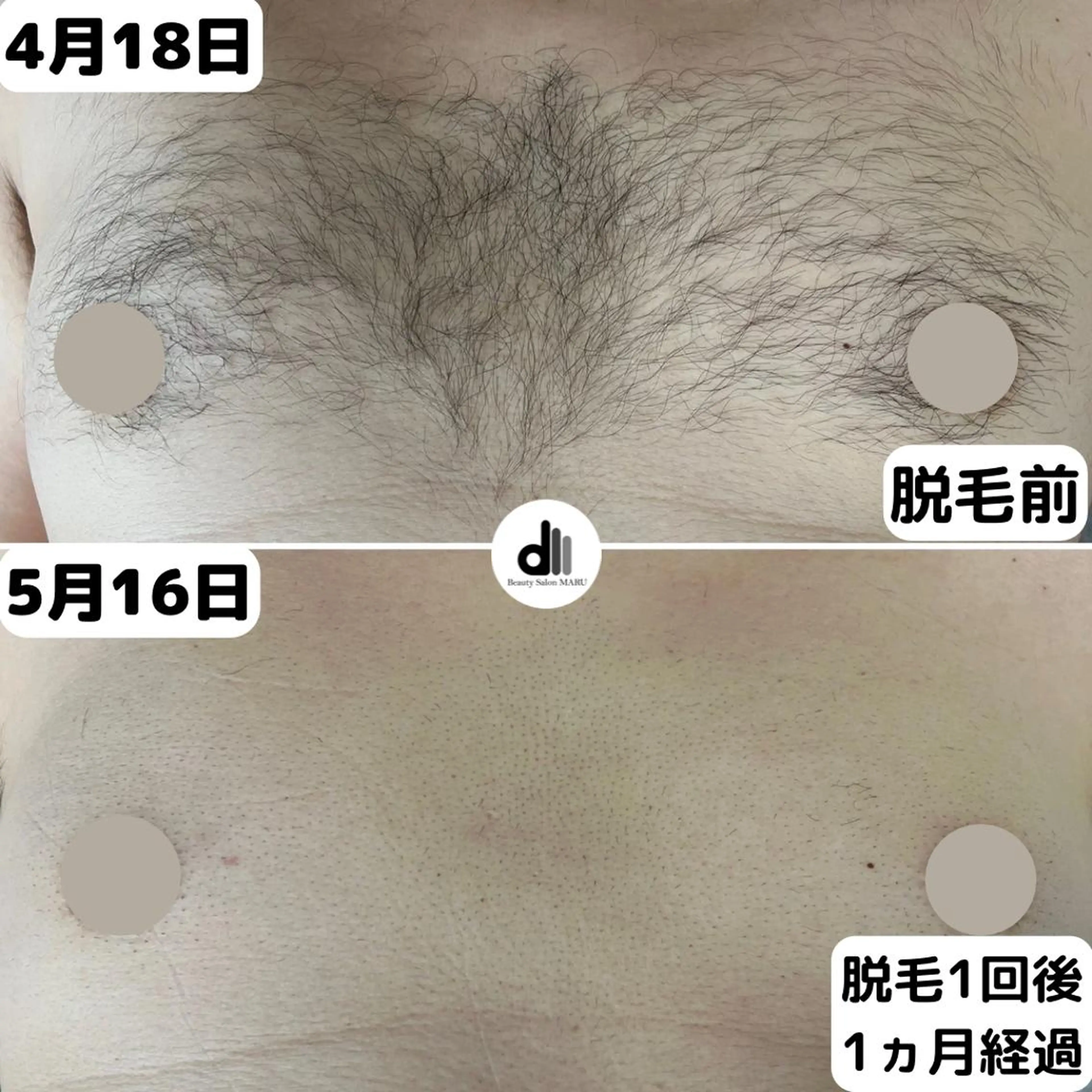 メンズ Beauty Salon MARU所属・新潟市メンズ【脱毛】 MARUのエステ・リラクイメージ