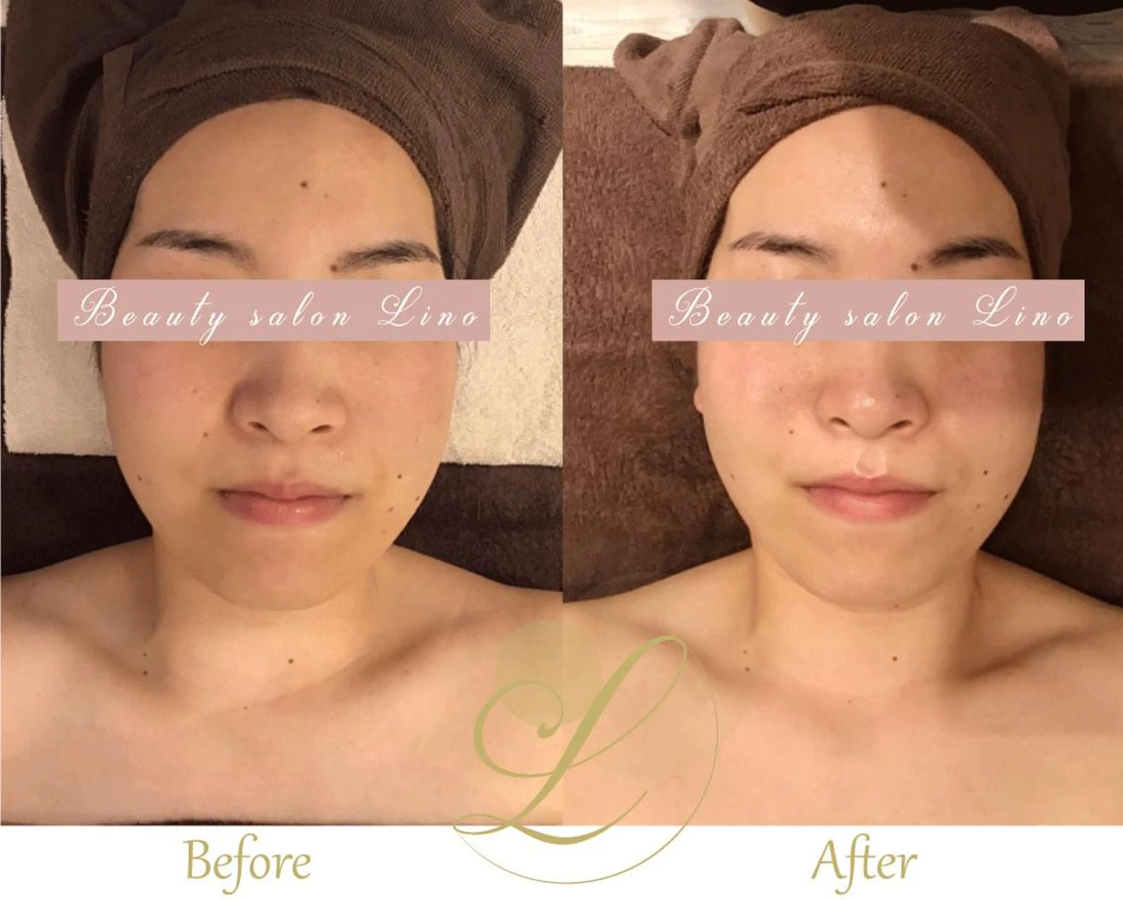 痩身×フェイシャル ブライダル|Linoのエステ・リラクイメージ