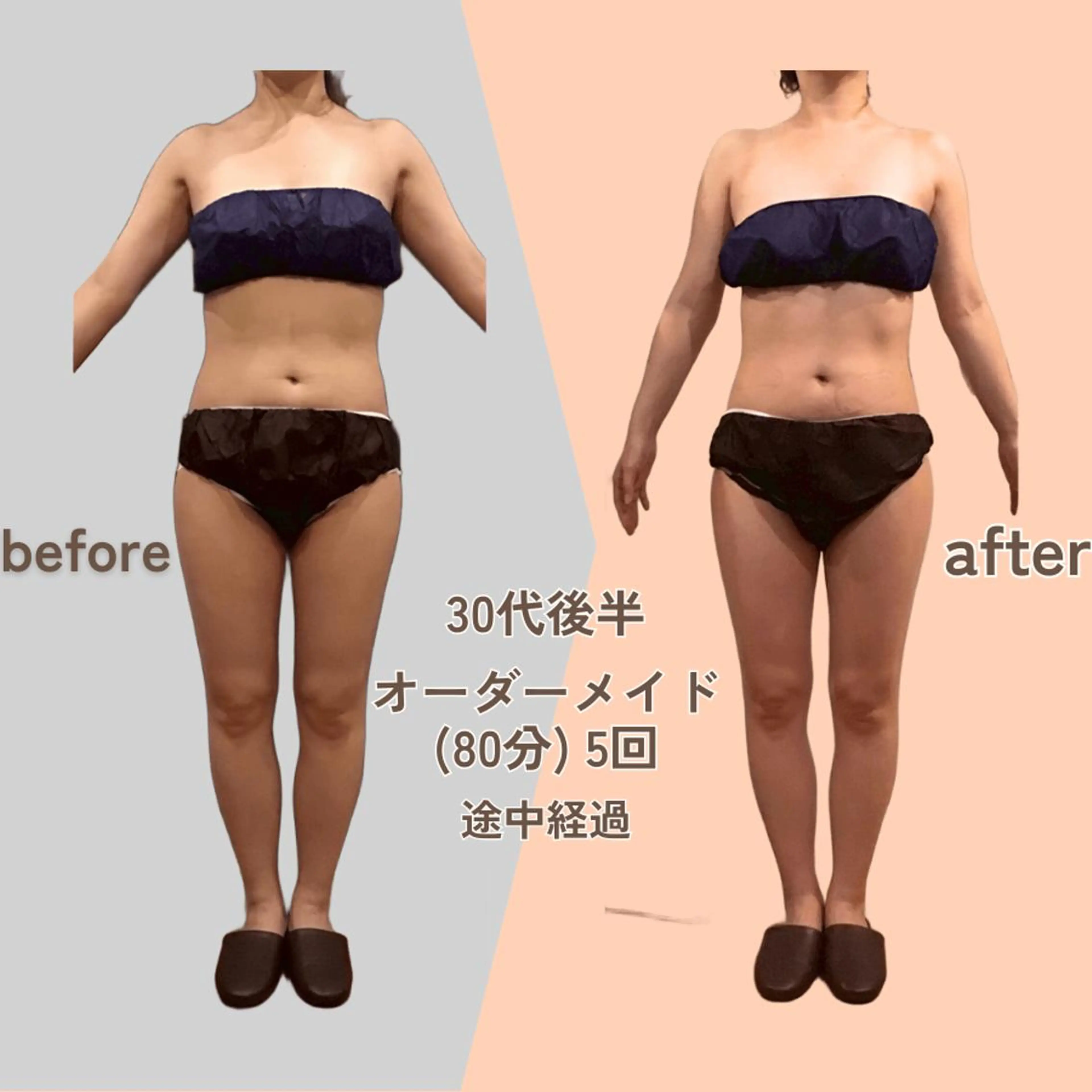 痩身エステ Julien麹町店のエステ・リラクイメージ