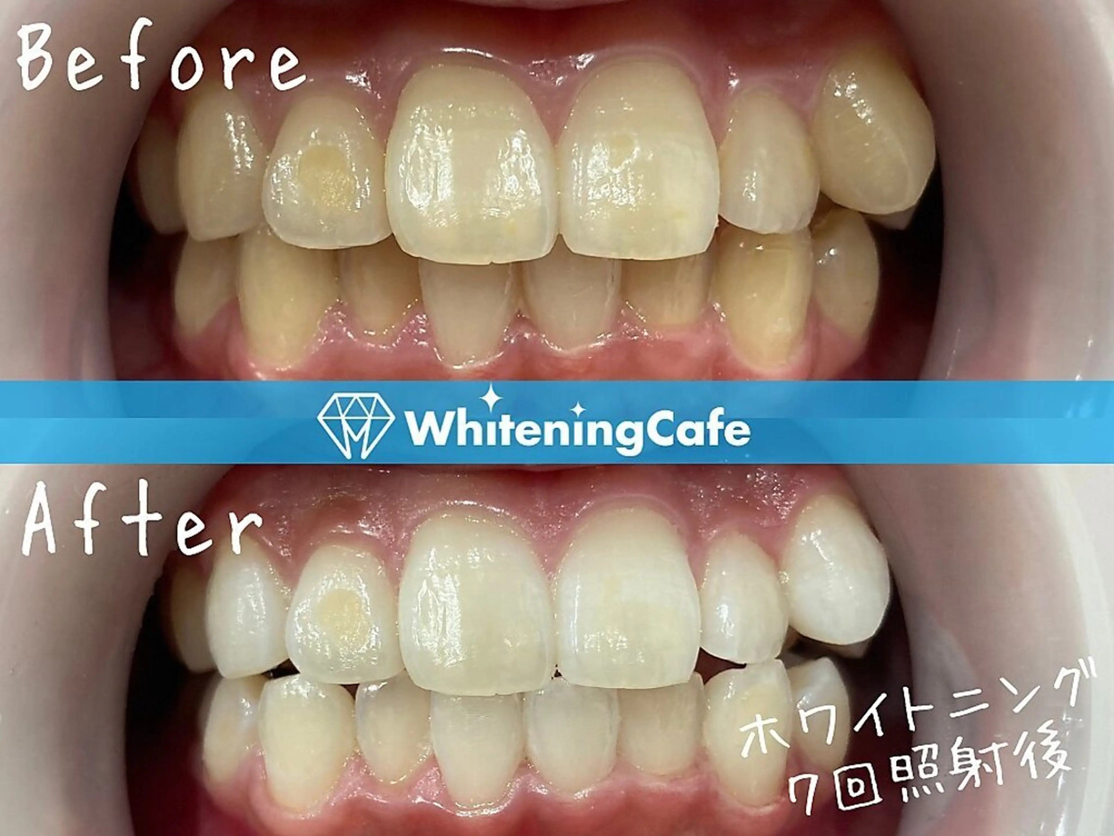 ホワイトニングカフェ中野店所属・ホワイトニングカフェ 中野店のその他イメージ