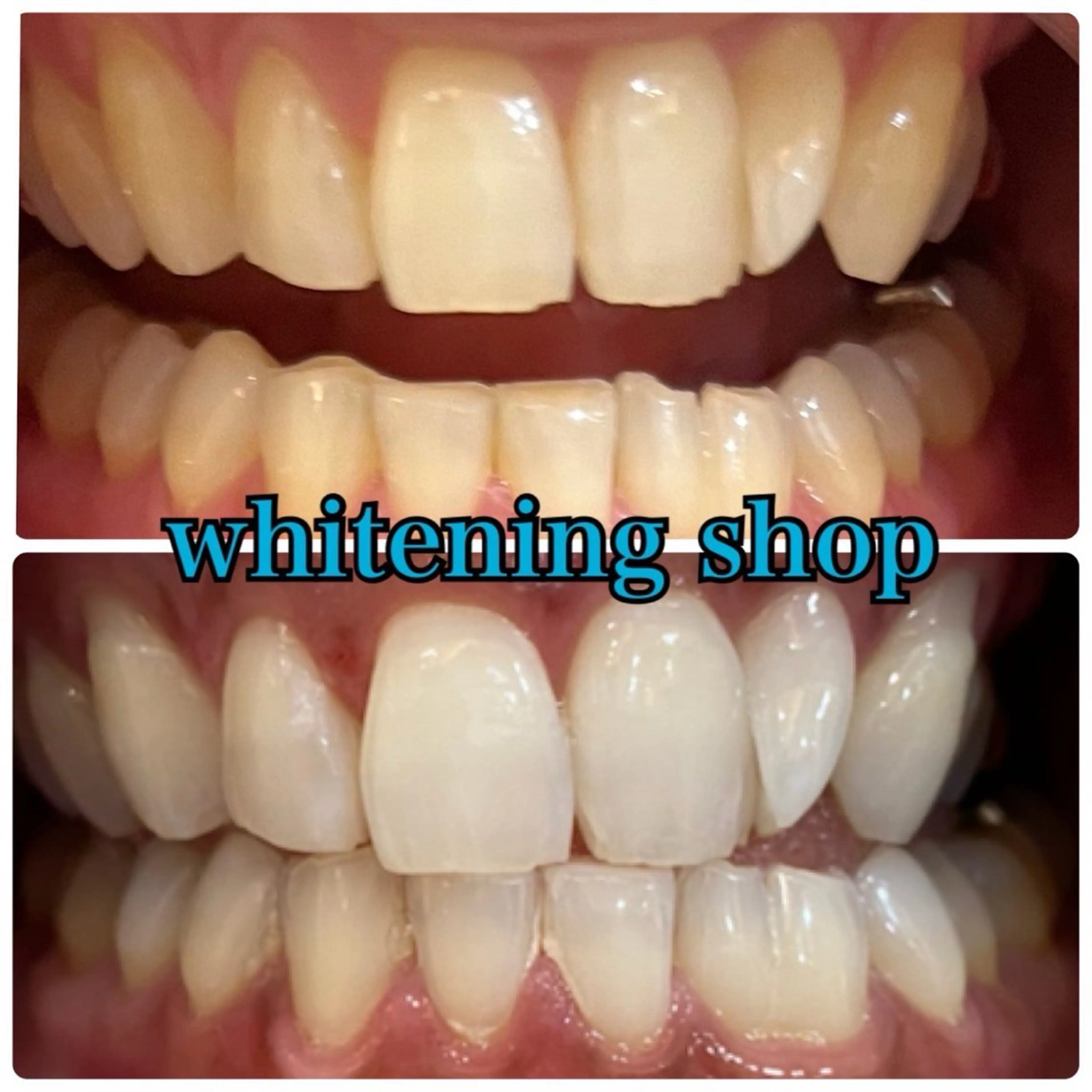 メンズ エステ リラク ホワイトニング ショップ川越店のエステ・リラクイメージ