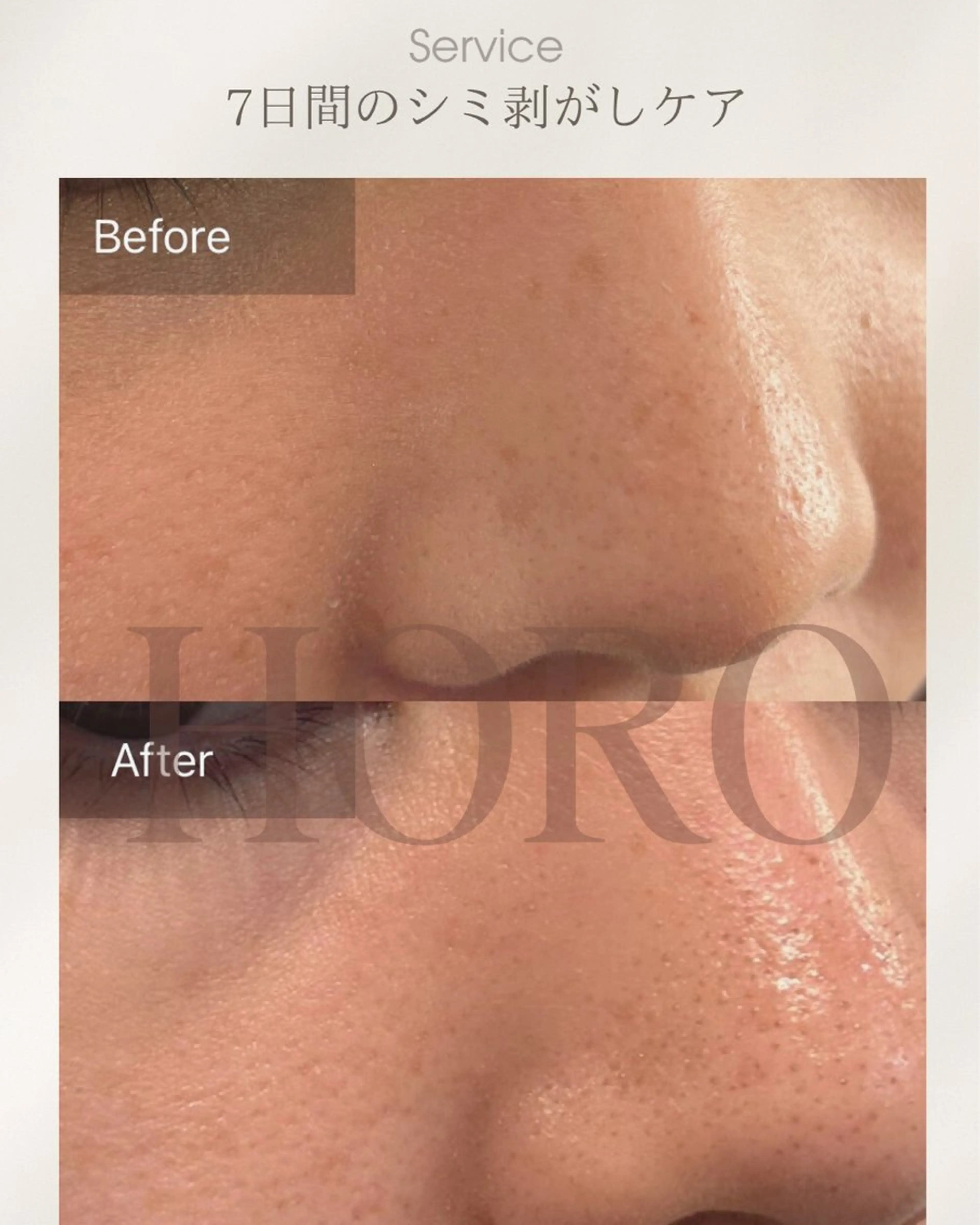 毛穴が見えなくなるサロン  Horo所属・岡 えり子のエステ・リラクイメージ