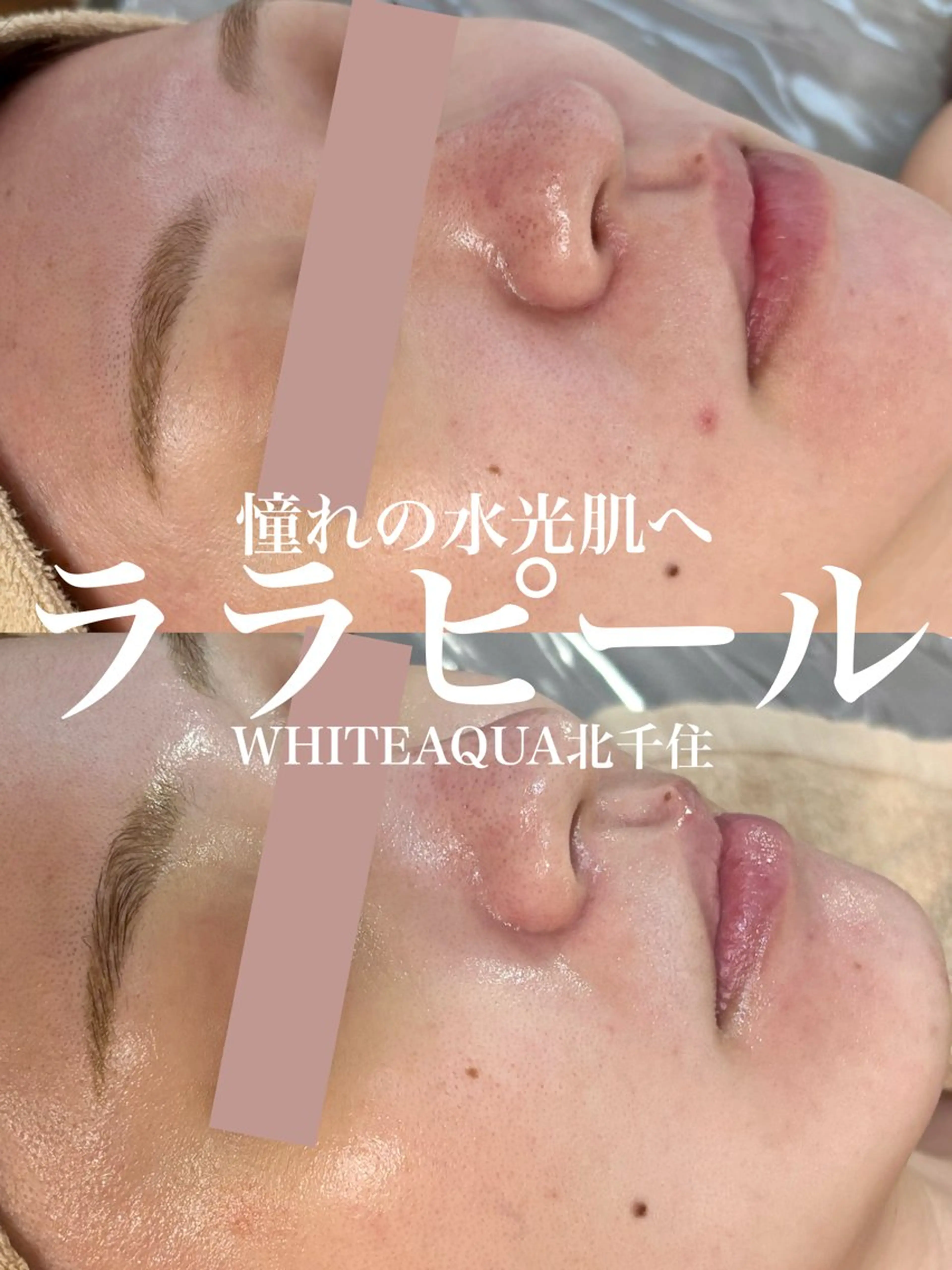 エステ WHITE AQUA 北千住店のエステ・リラクイメージ