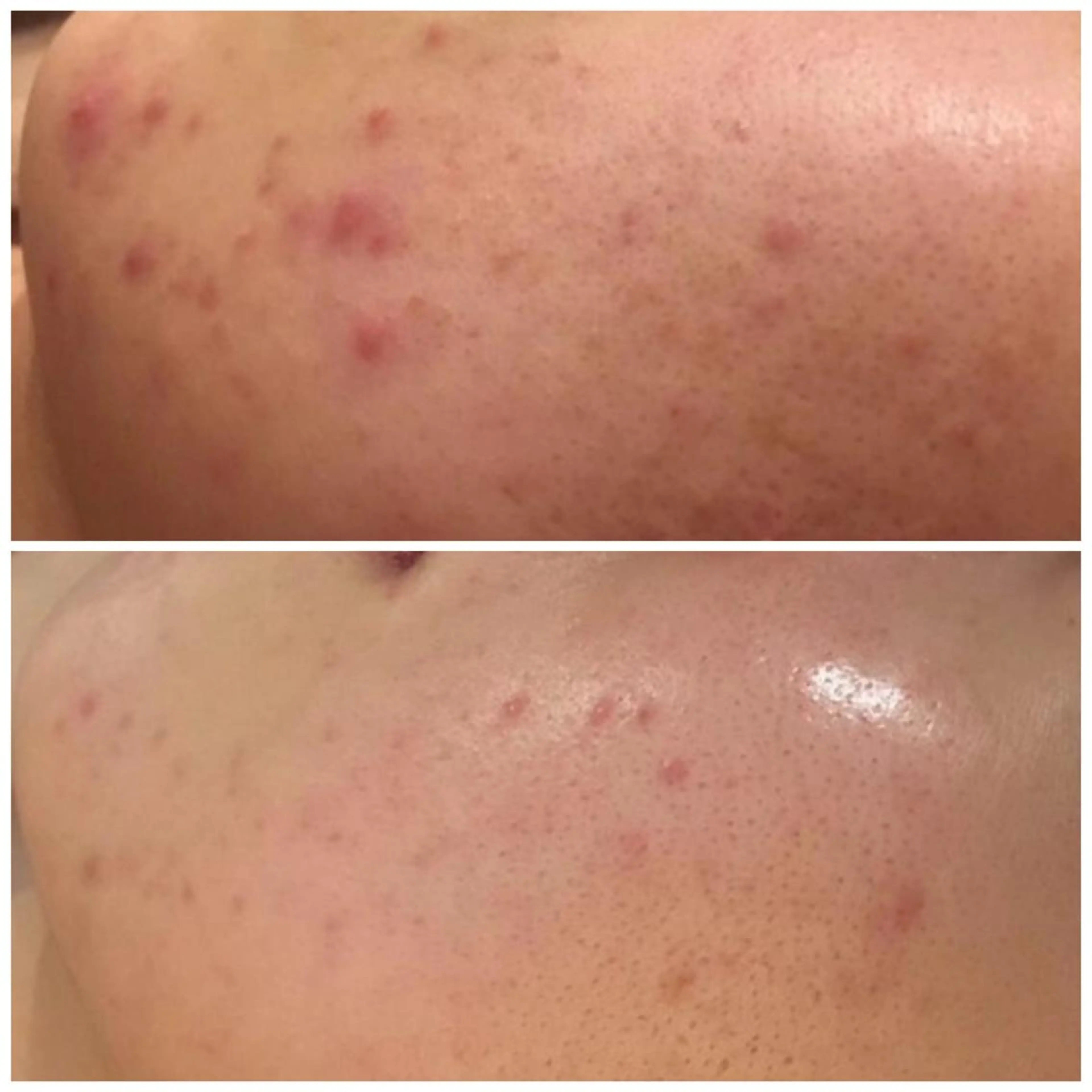 触れたくなる モテ肌へ...❤︎のエステ・リラクイメージ