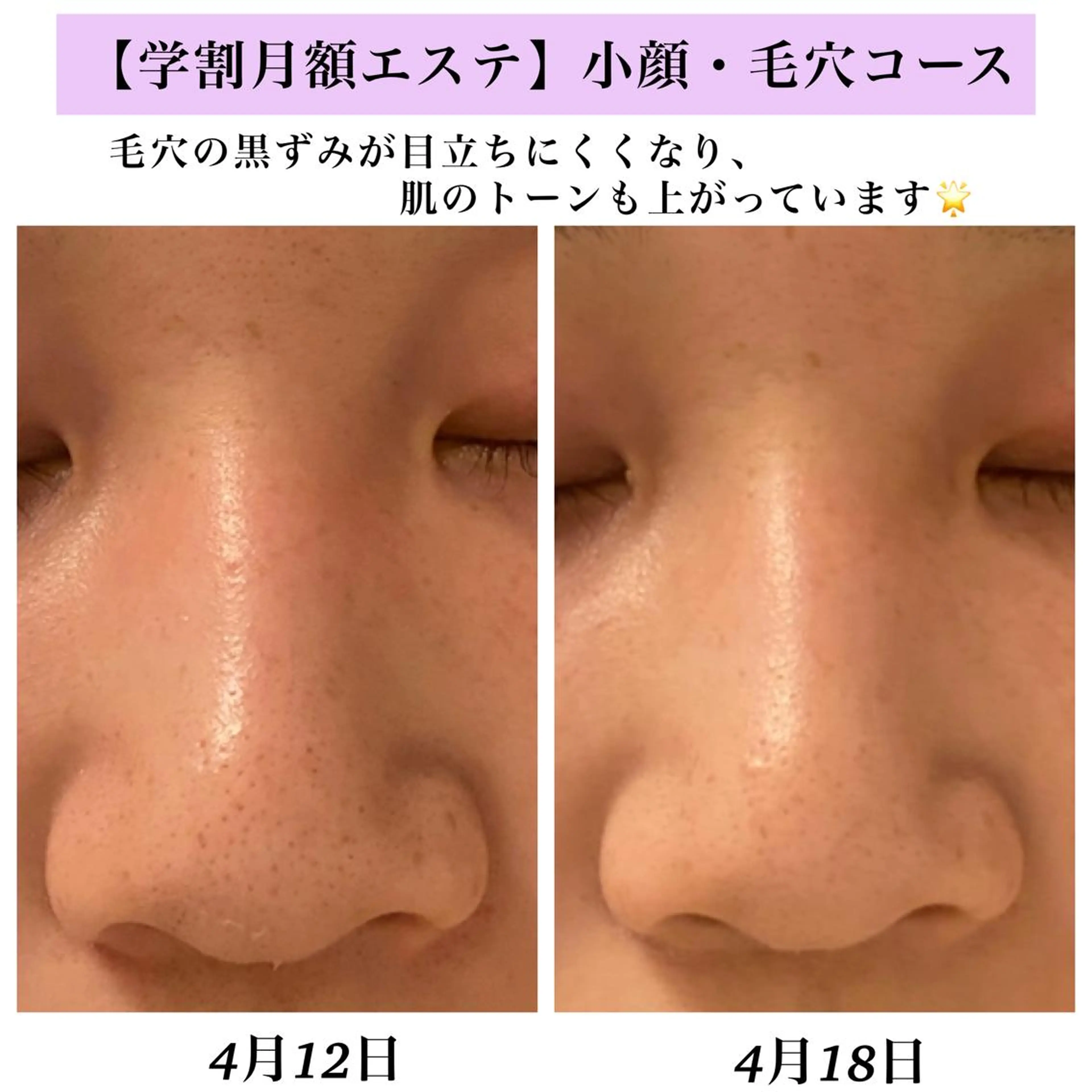 Bellesthe （ベルエステ）のエステ・リラクイメージ