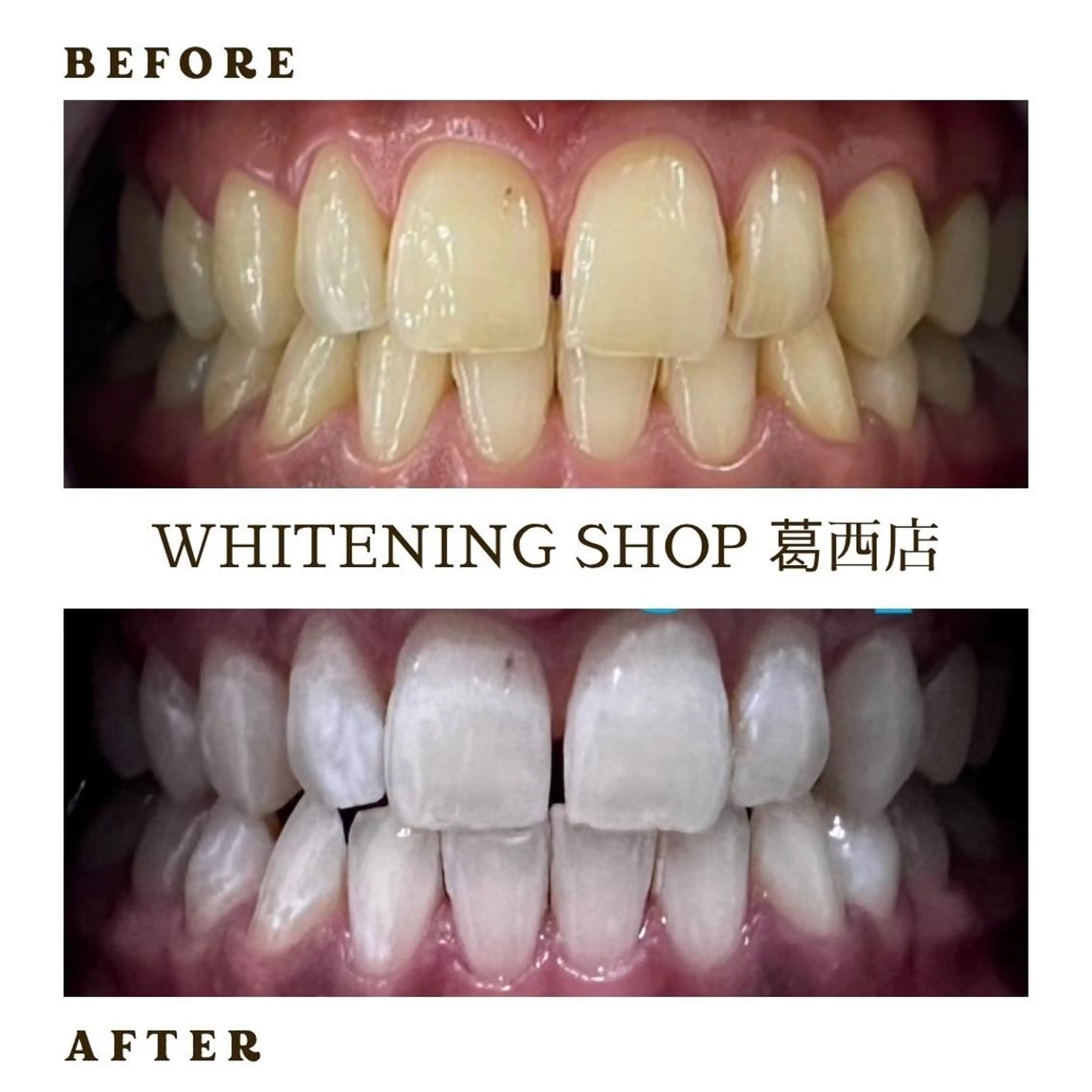 その他 ホワイトニング ショップ葛西店のその他イメージ