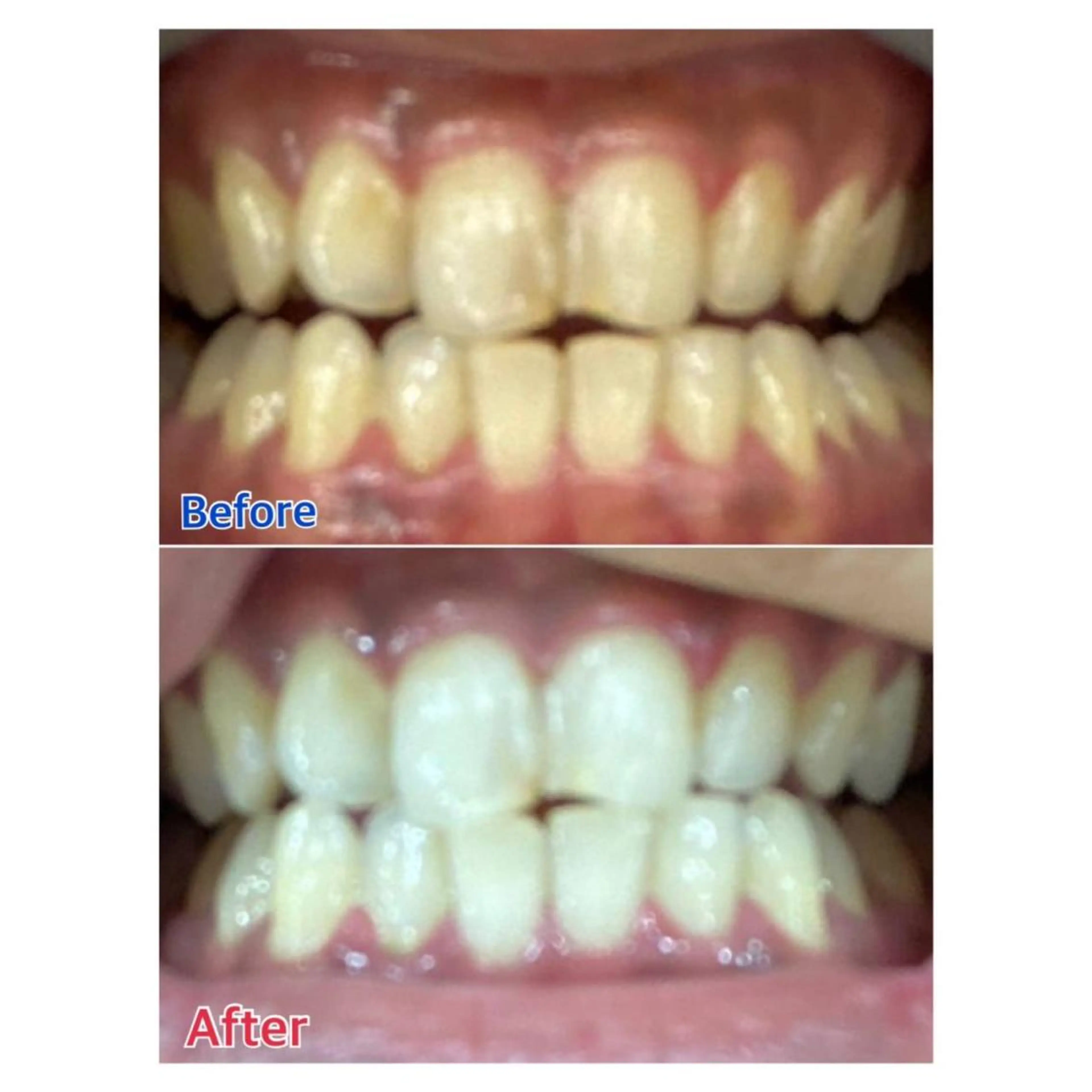 MBEAUTYSALON 千葉店・京成大久保所属・Melty 輝のその他イメージ