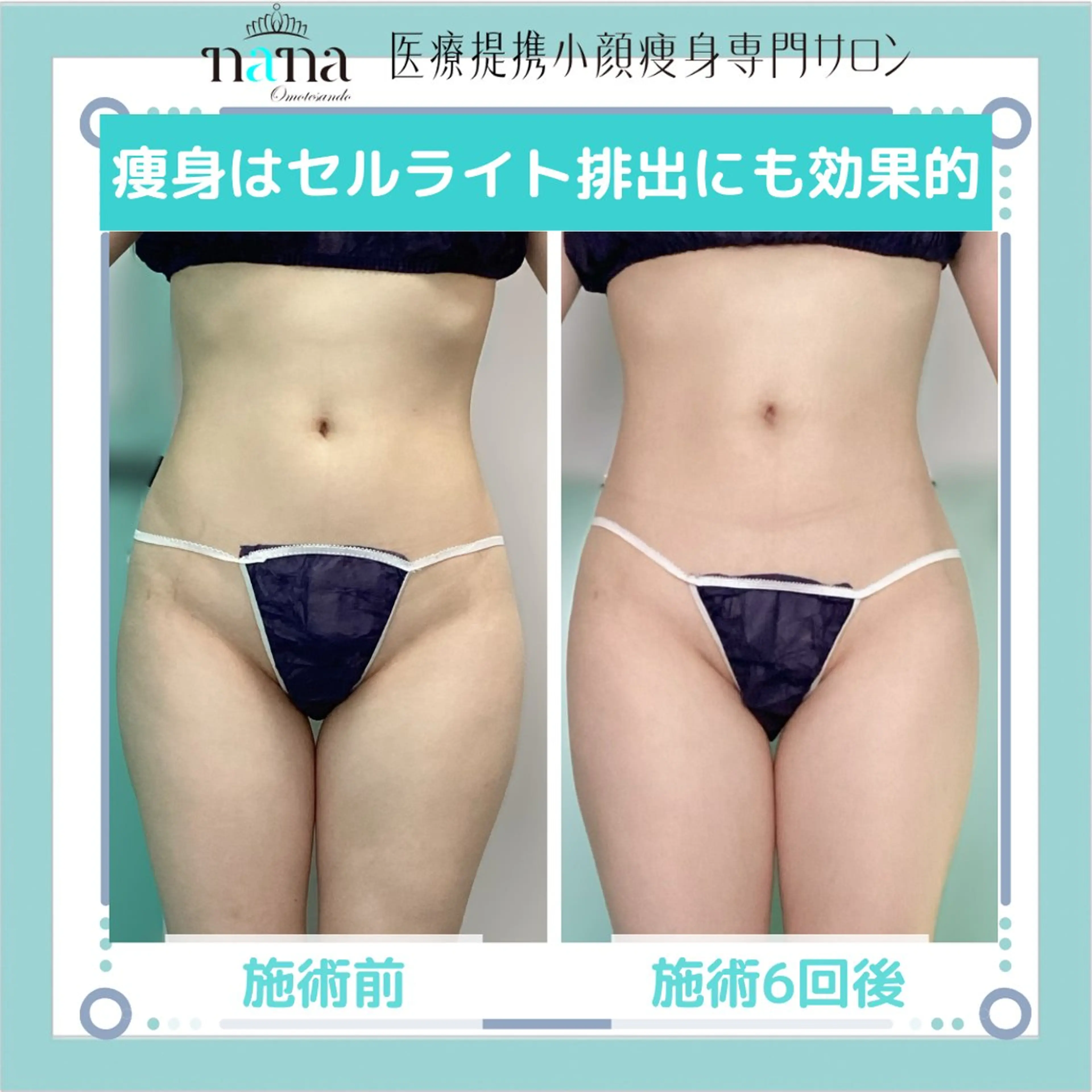 小顔痩身インディバ Nana表参道のエステ・リラクイメージ