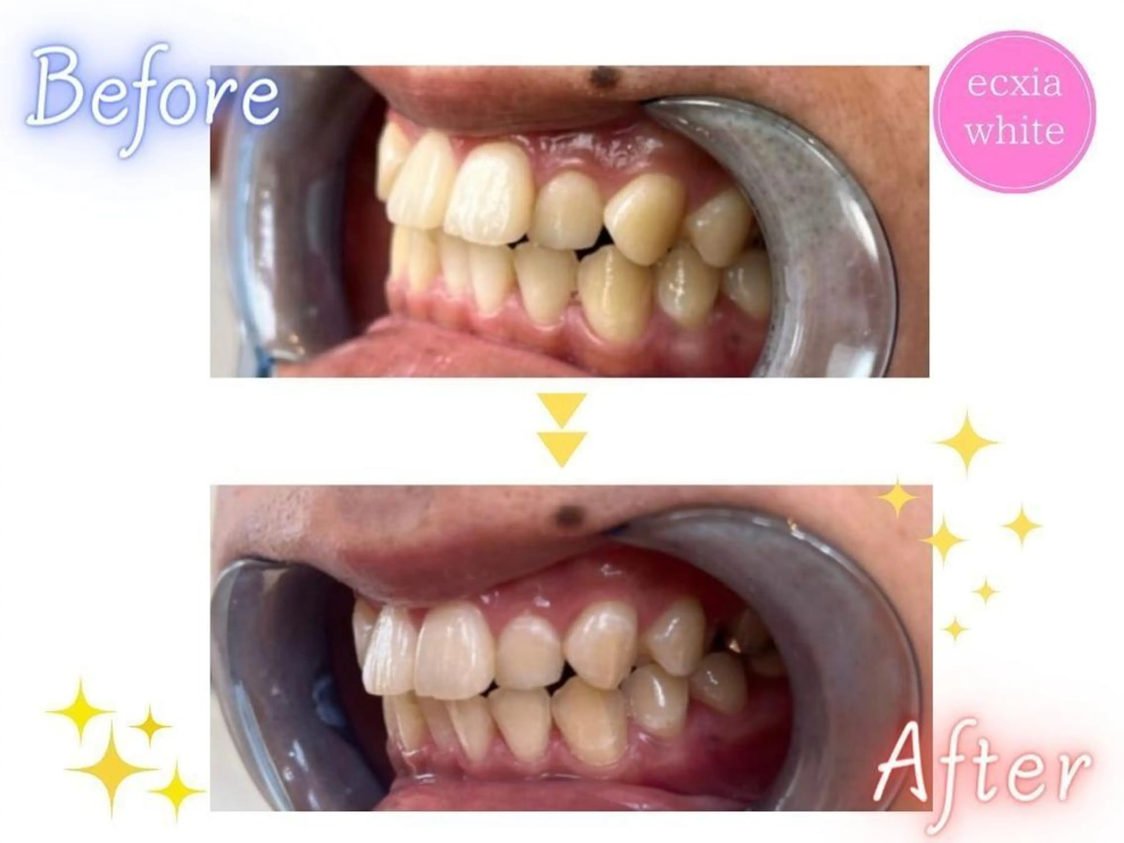 セルフホワイトニング エクシア五反田店のその他イメージ