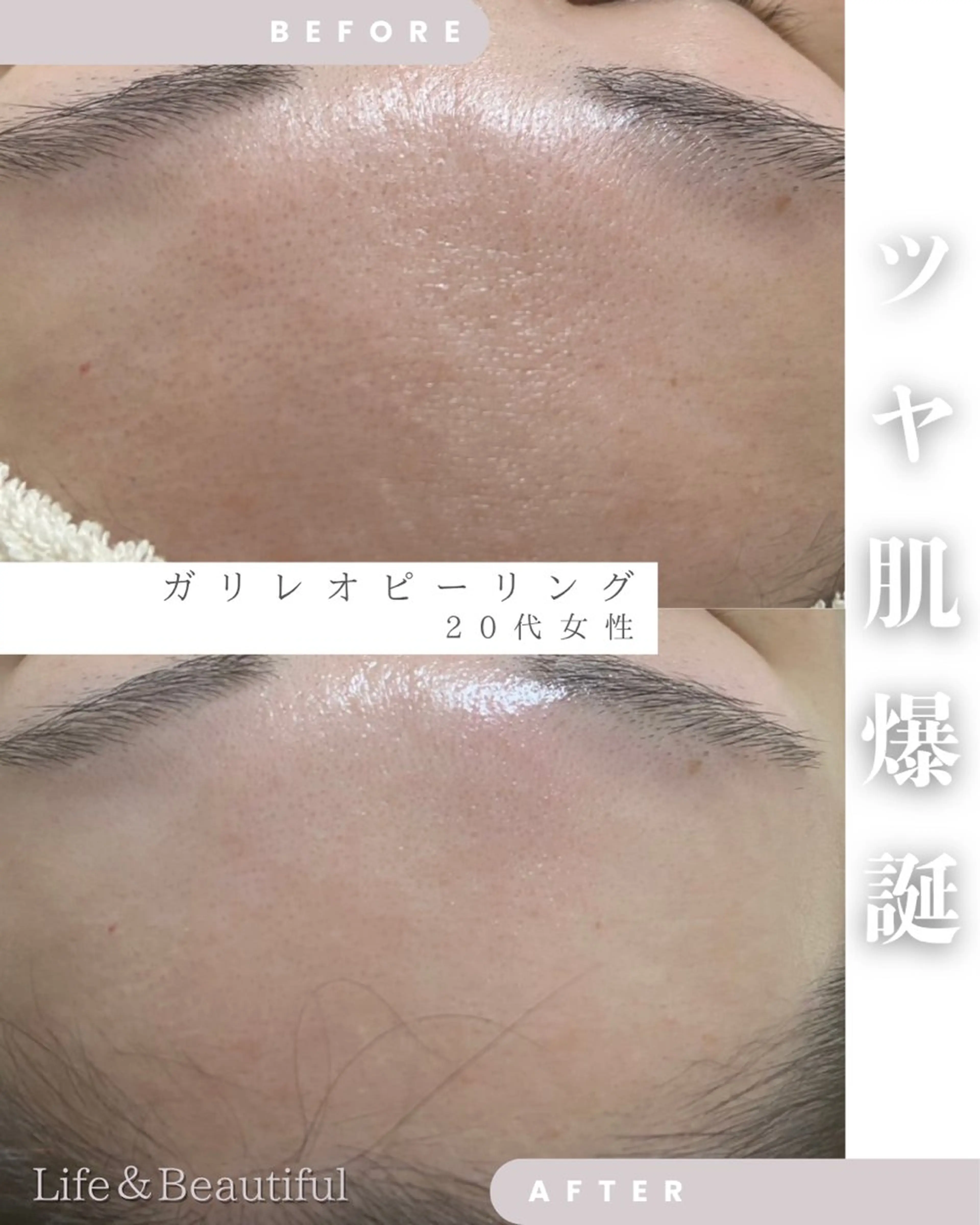 エステ Life＆ Beautifulのエステ・リラクイメージ