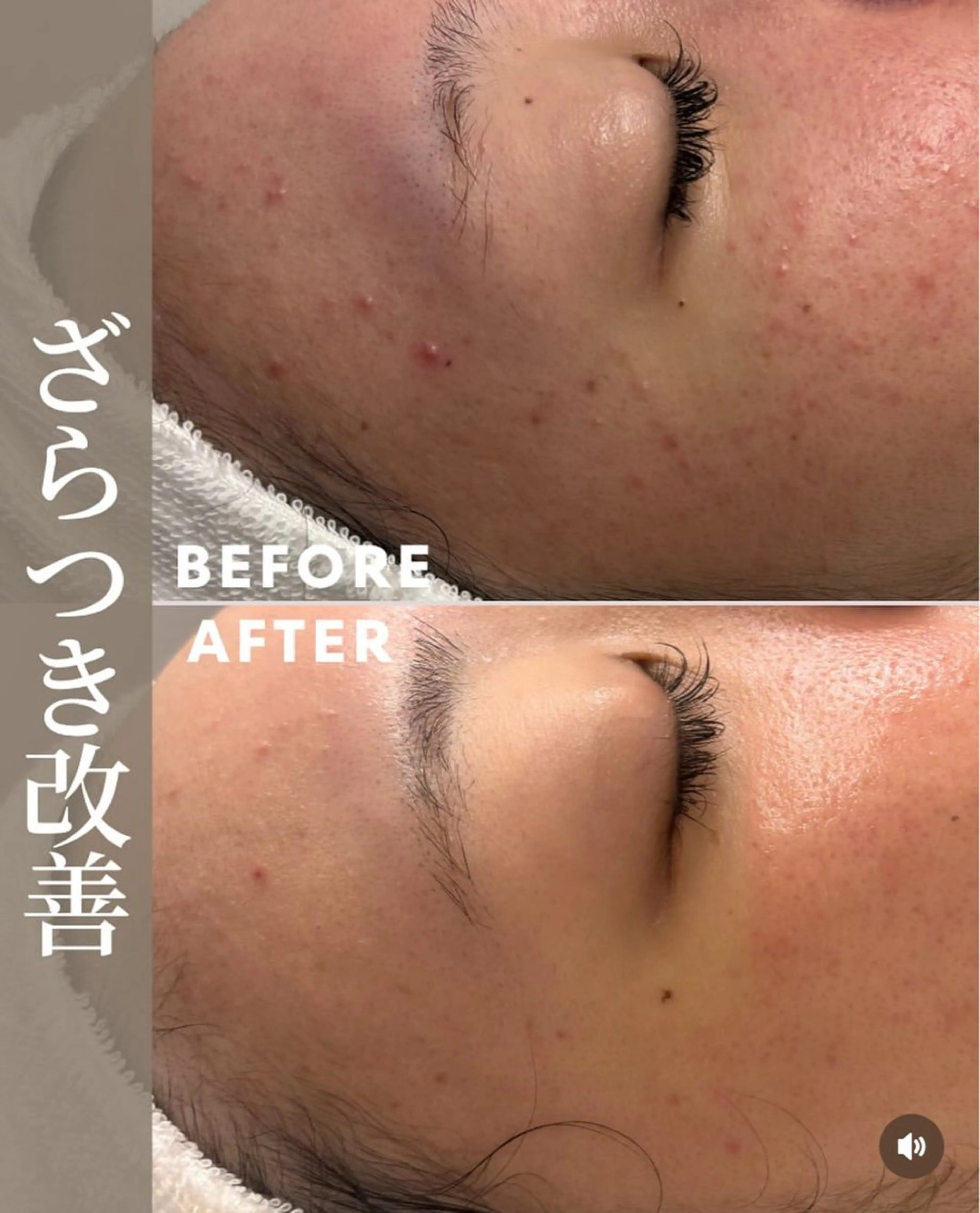 肌育成サロン ♡ 村田理紗のエステ・リラクイメージ