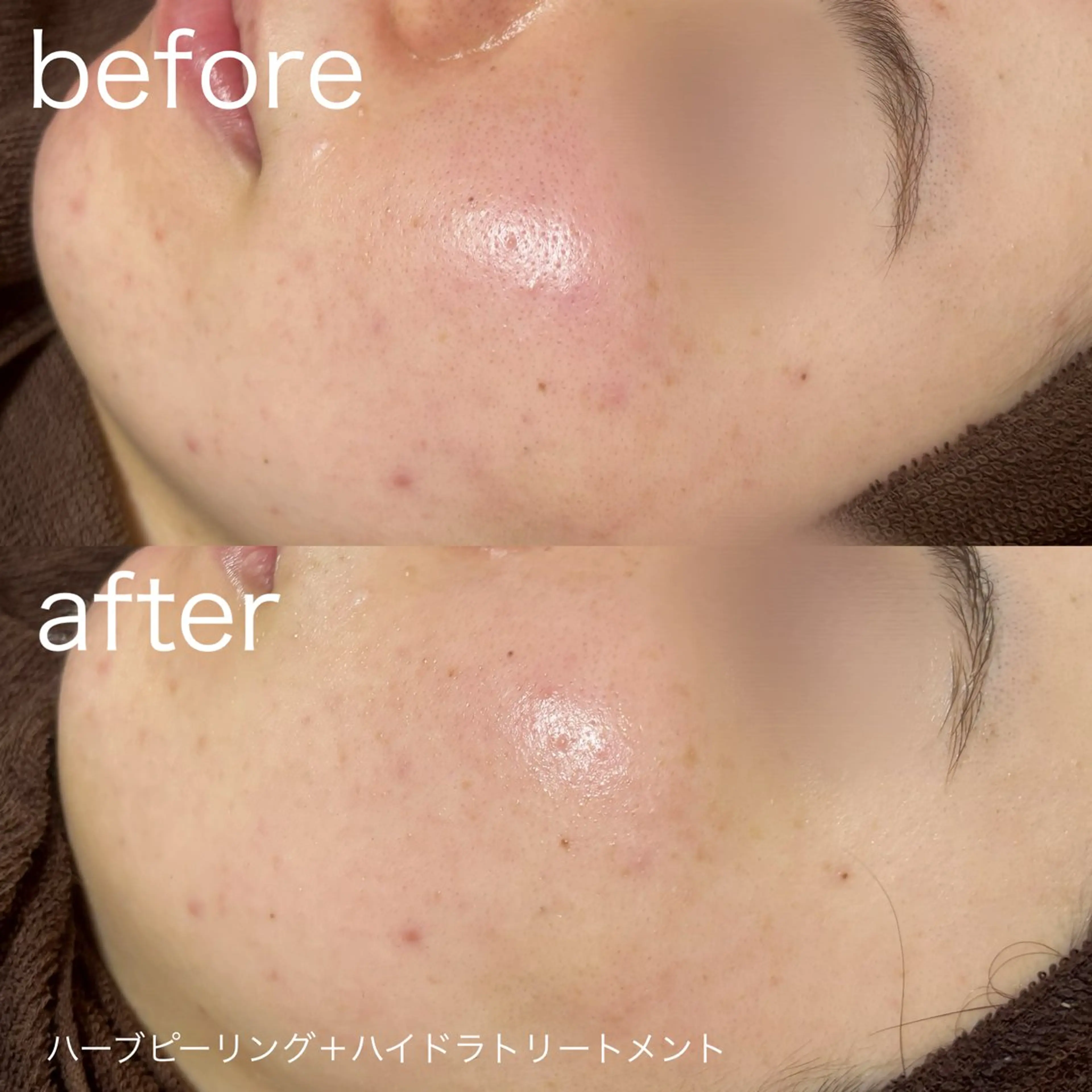 脱毛 lulularico Yuのエステ・リラクイメージ