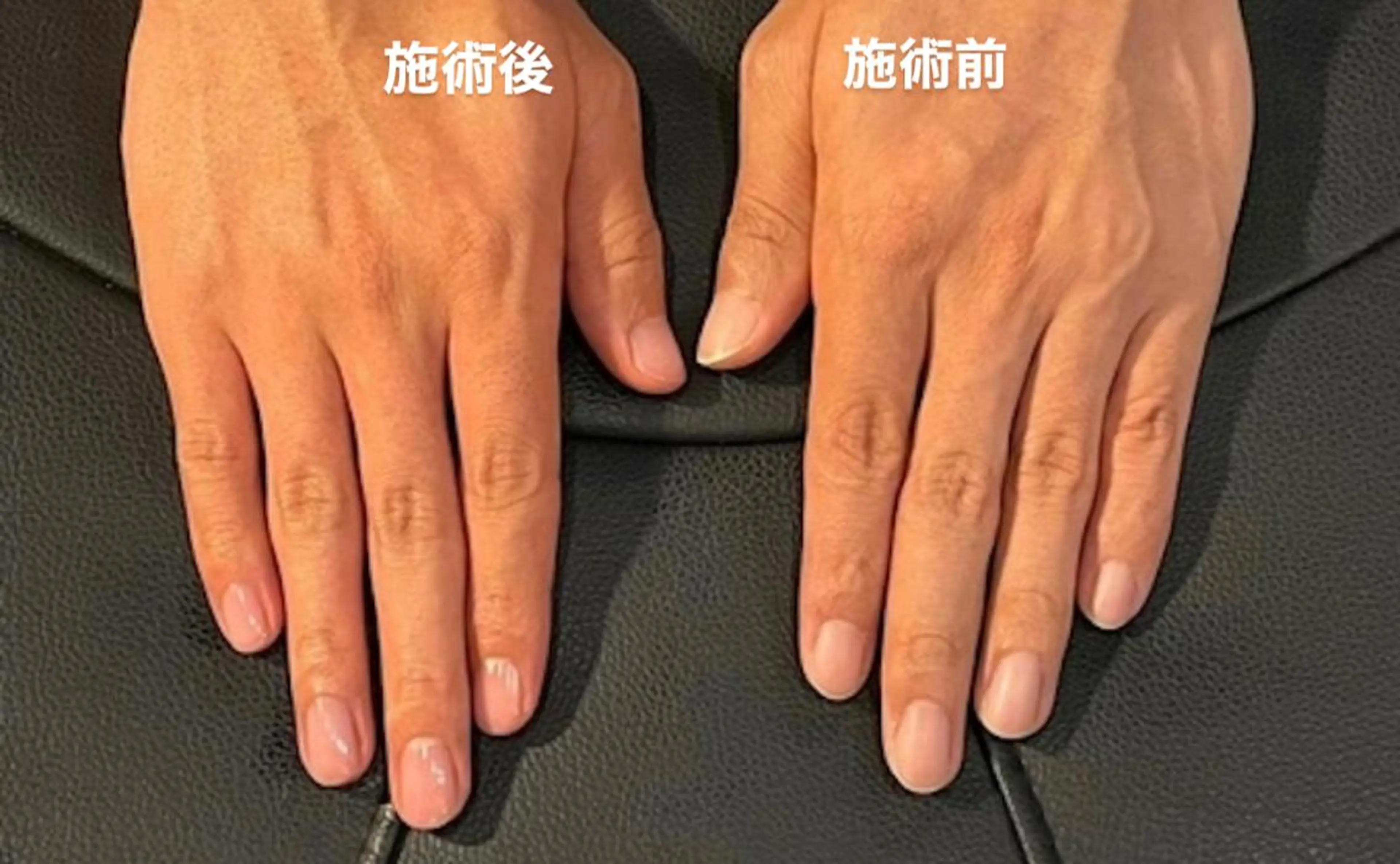 ネイル 自爪育成／ケアサロン 🤍leewayのネイルデザイン