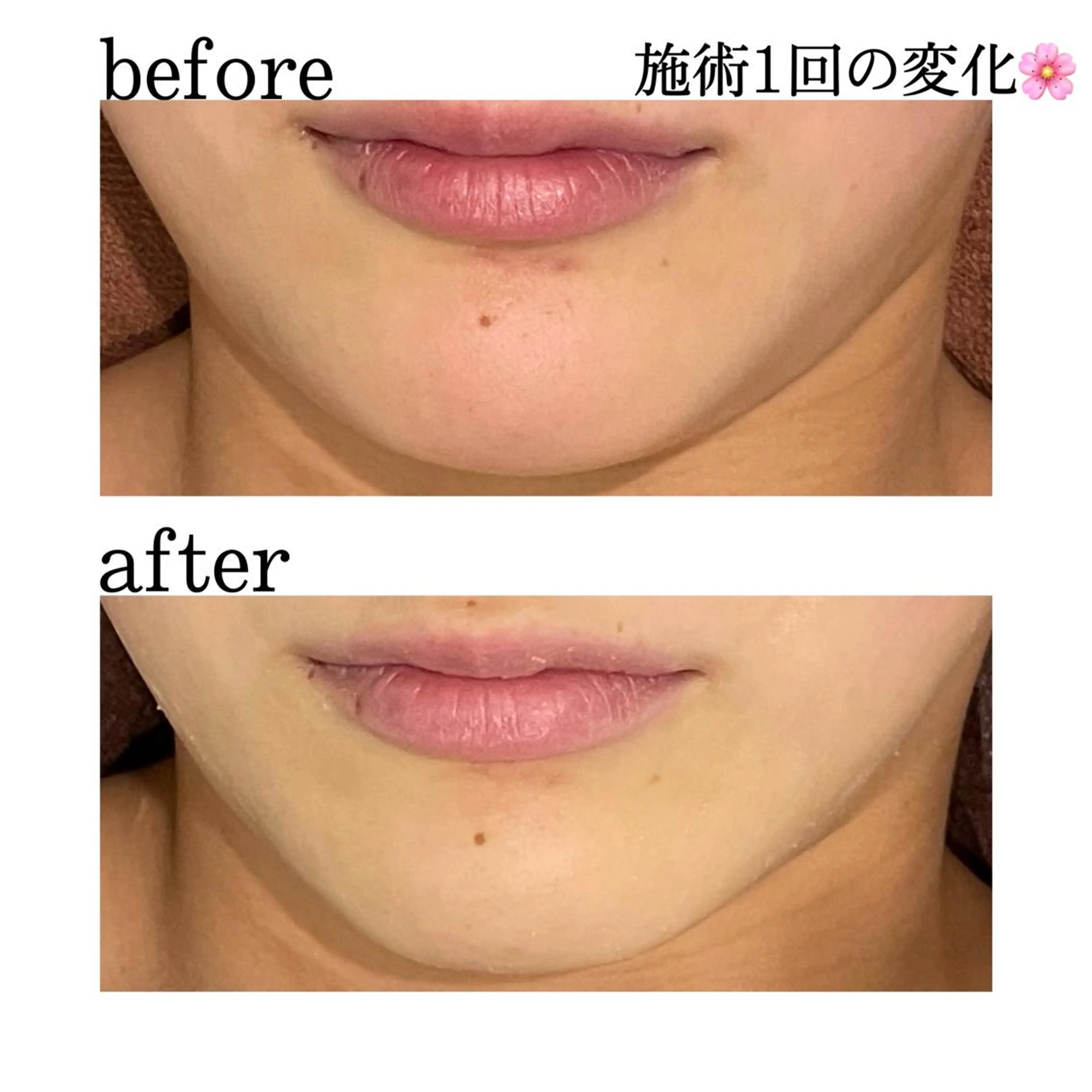 触れたくなる モテ肌へ...❤︎のエステ・リラクイメージ