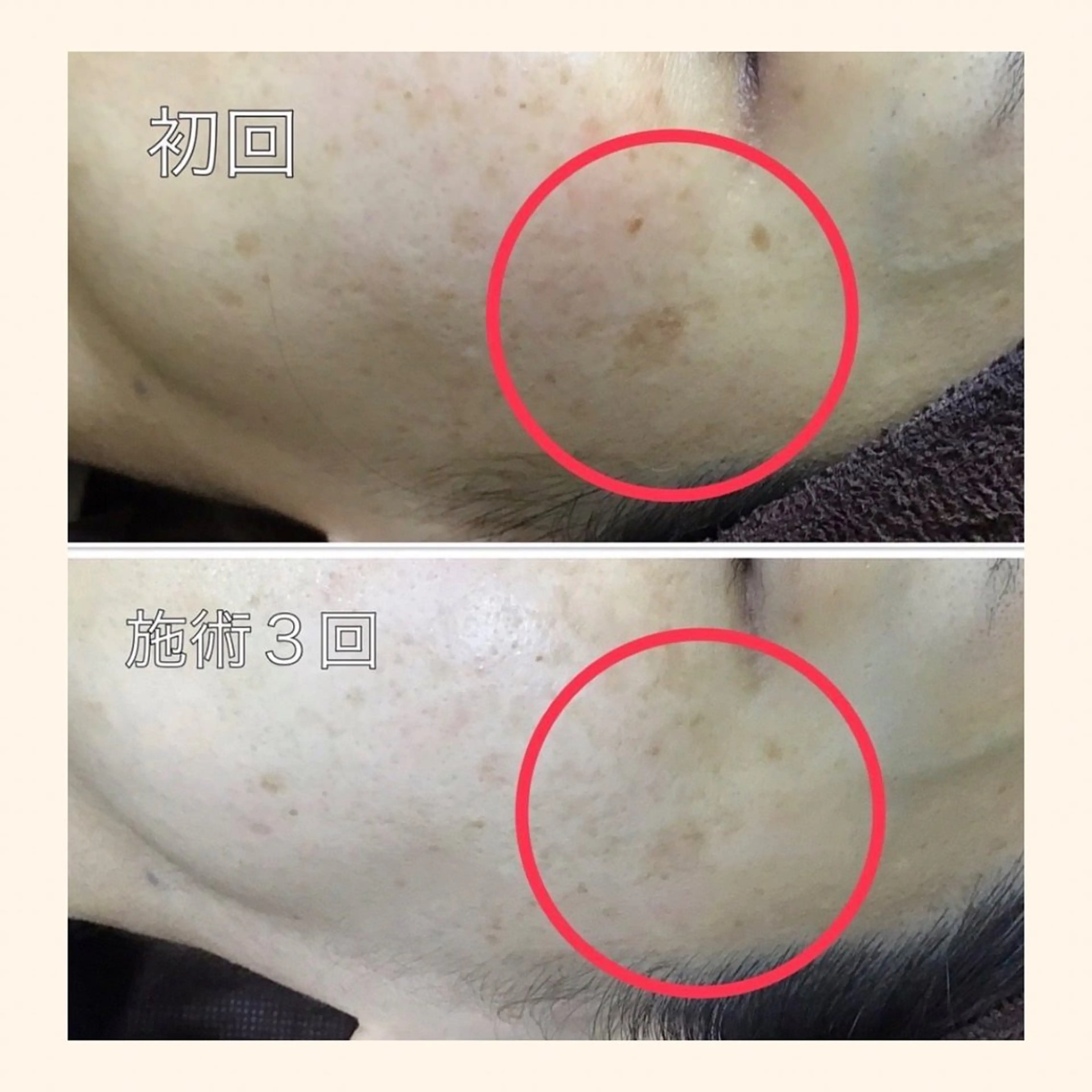 マツエク・マツパ その他 韓国肌管理 【毛穴専科】のエステ・リラクイメージ