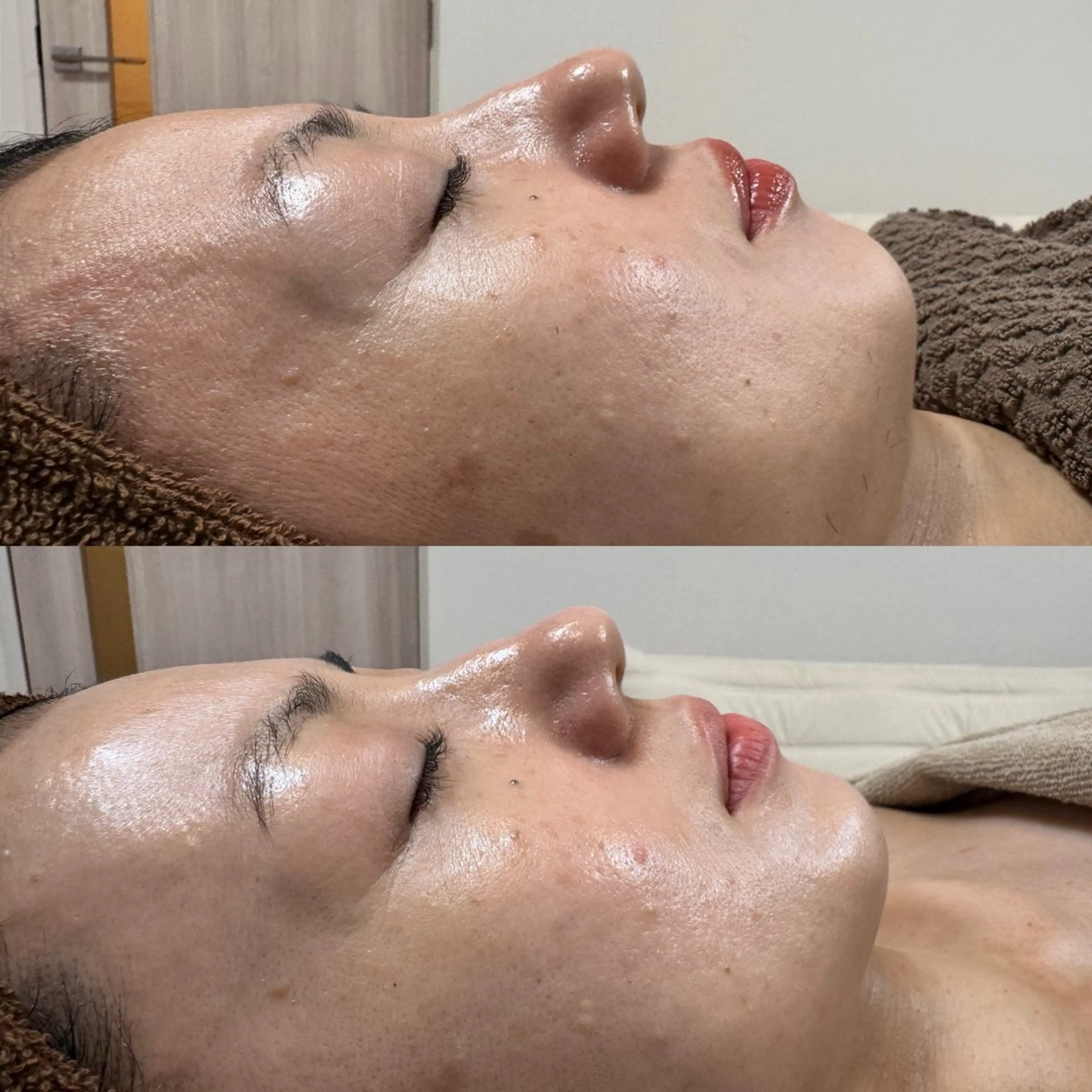 エステ skinity所属・ピーリング専門サロン skinityのエステ・リラクイメージ