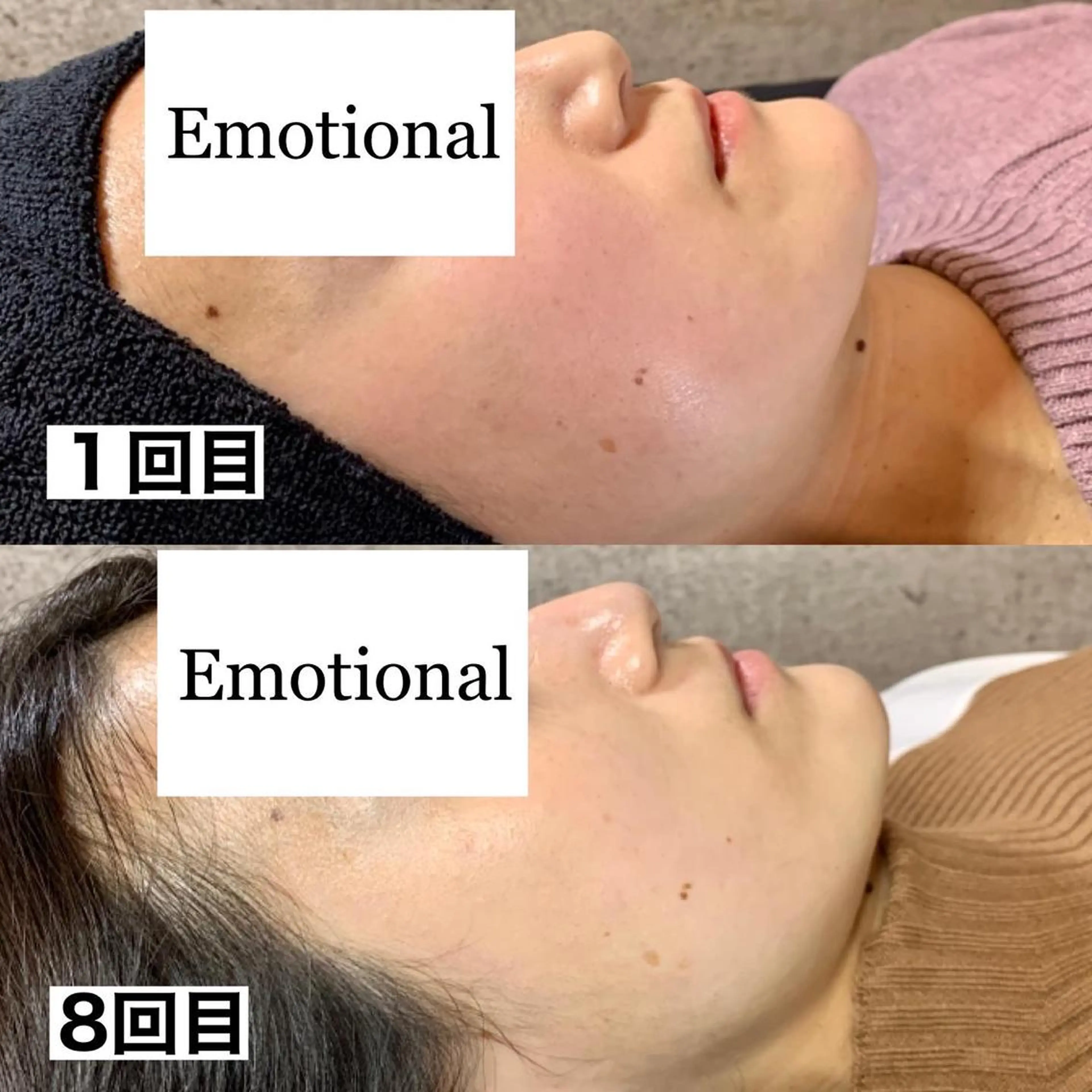 エステ リラク 姫路ハーブピーリング・韓国肌管理専門店Emotional所属・Yuka .のエステ・リラクイメージ