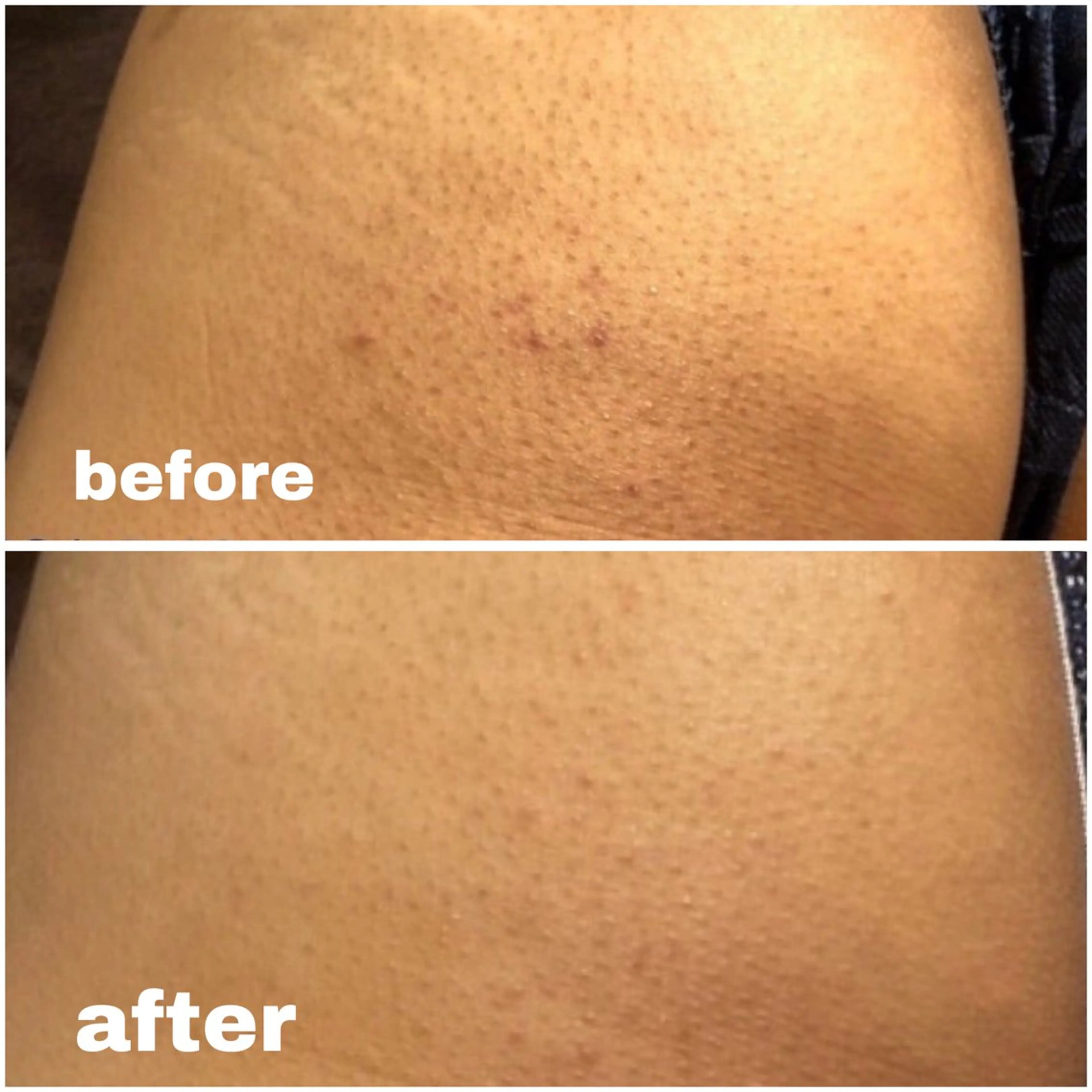 ハーブピーリング re:proのエステ・リラクイメージ