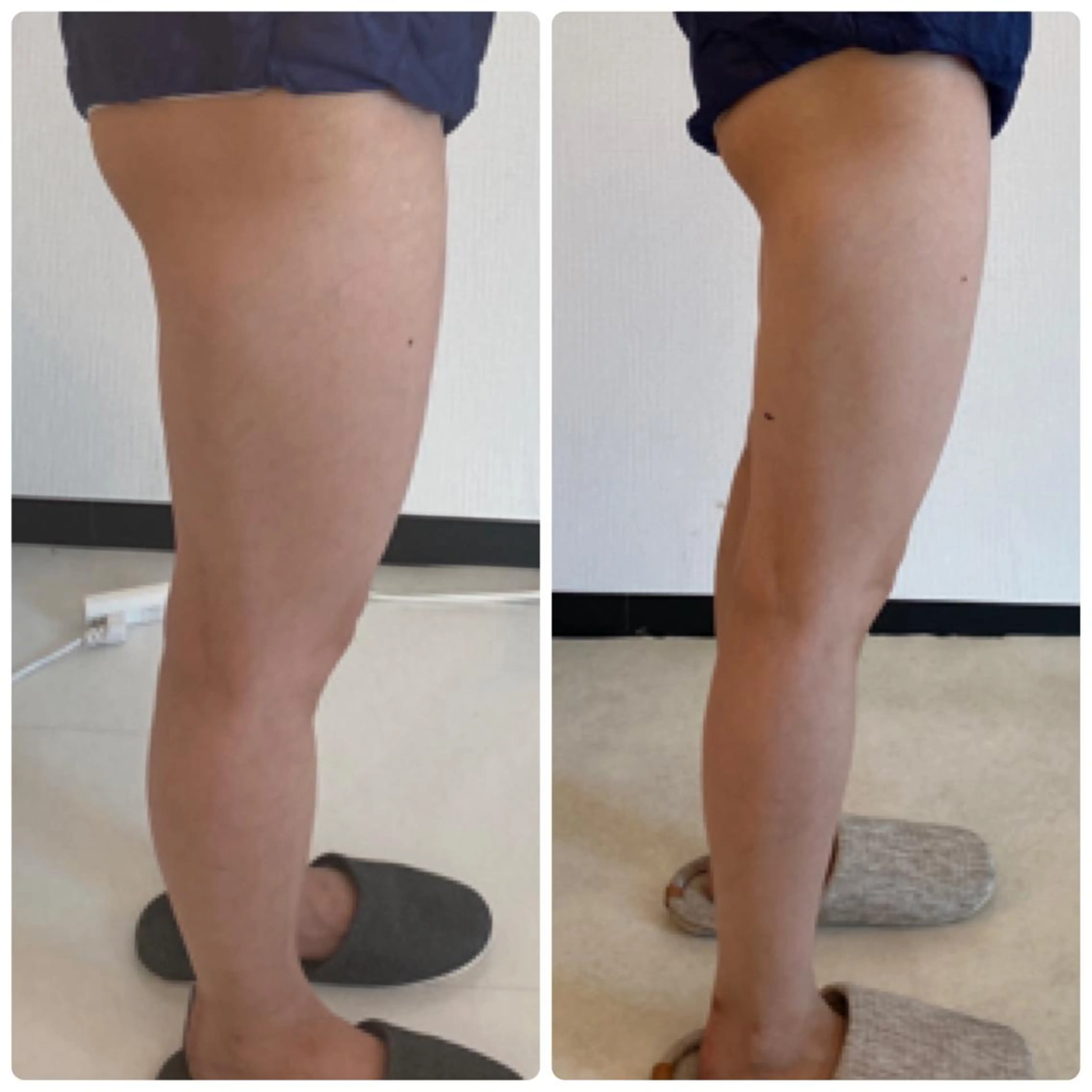 FLEUR大阪・整体 ・ハイフ・痩身・小顔のエステ・リラクイメージ