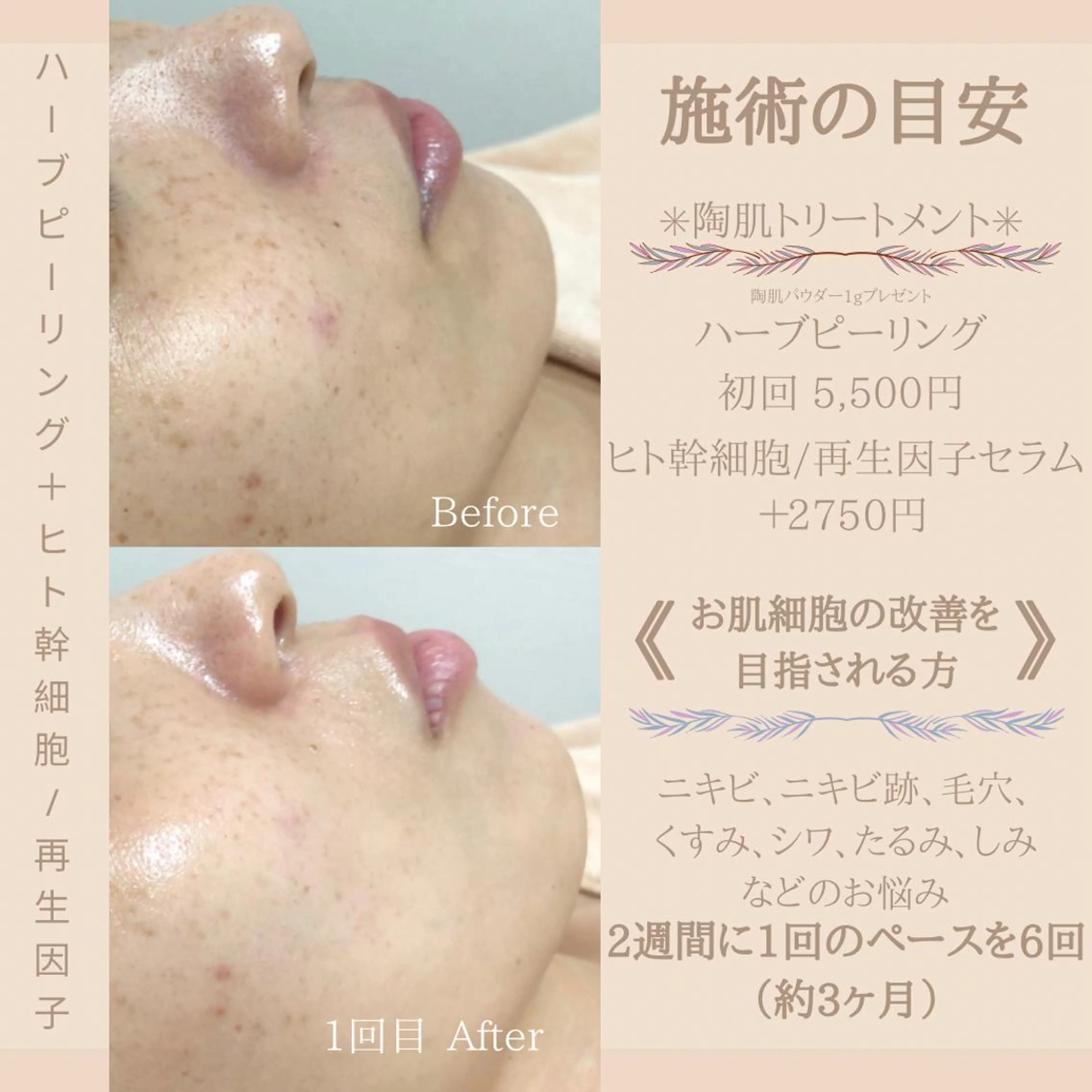 ミディアム カラー パーマ ヘアアレンジ メンズ キッズ ネイル マツエク・マツパ アイブロウ 眉毛とフェイシャル 【muni】福島野田の眉毛・アイブロウイメージ