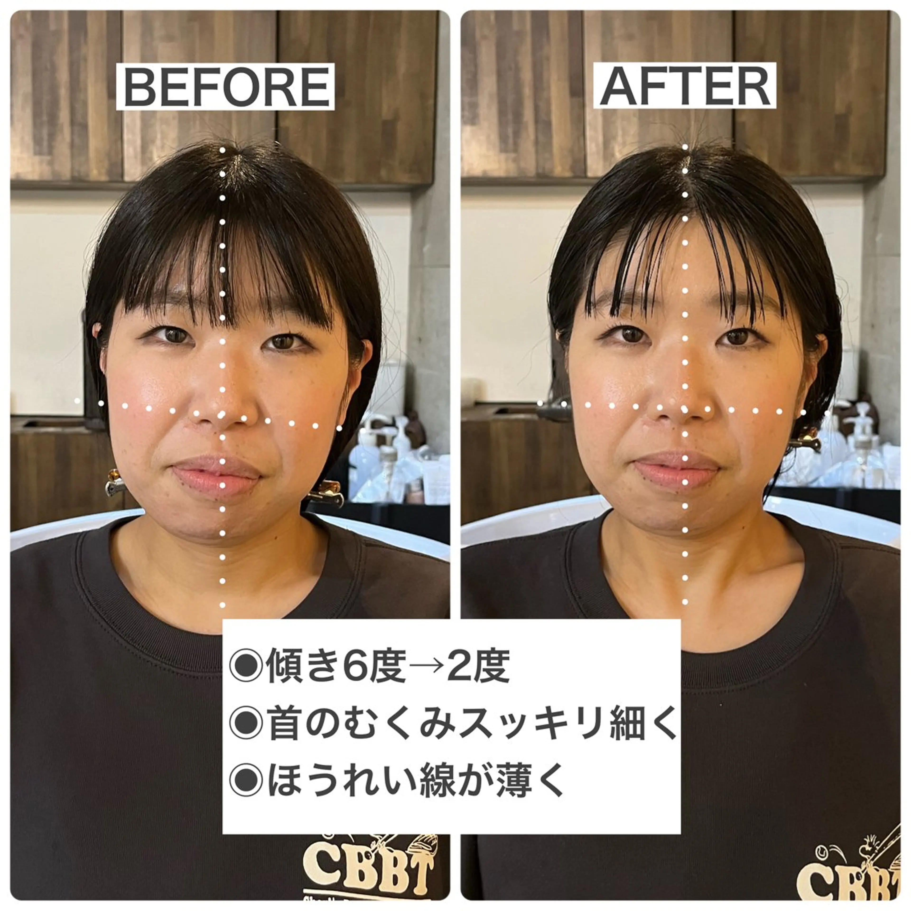 トリートメント ヘッドスパ acoord三軒茶屋所属・OLLIE/耳つぼ 💎骨格補正スパ🫧のその他イメージ