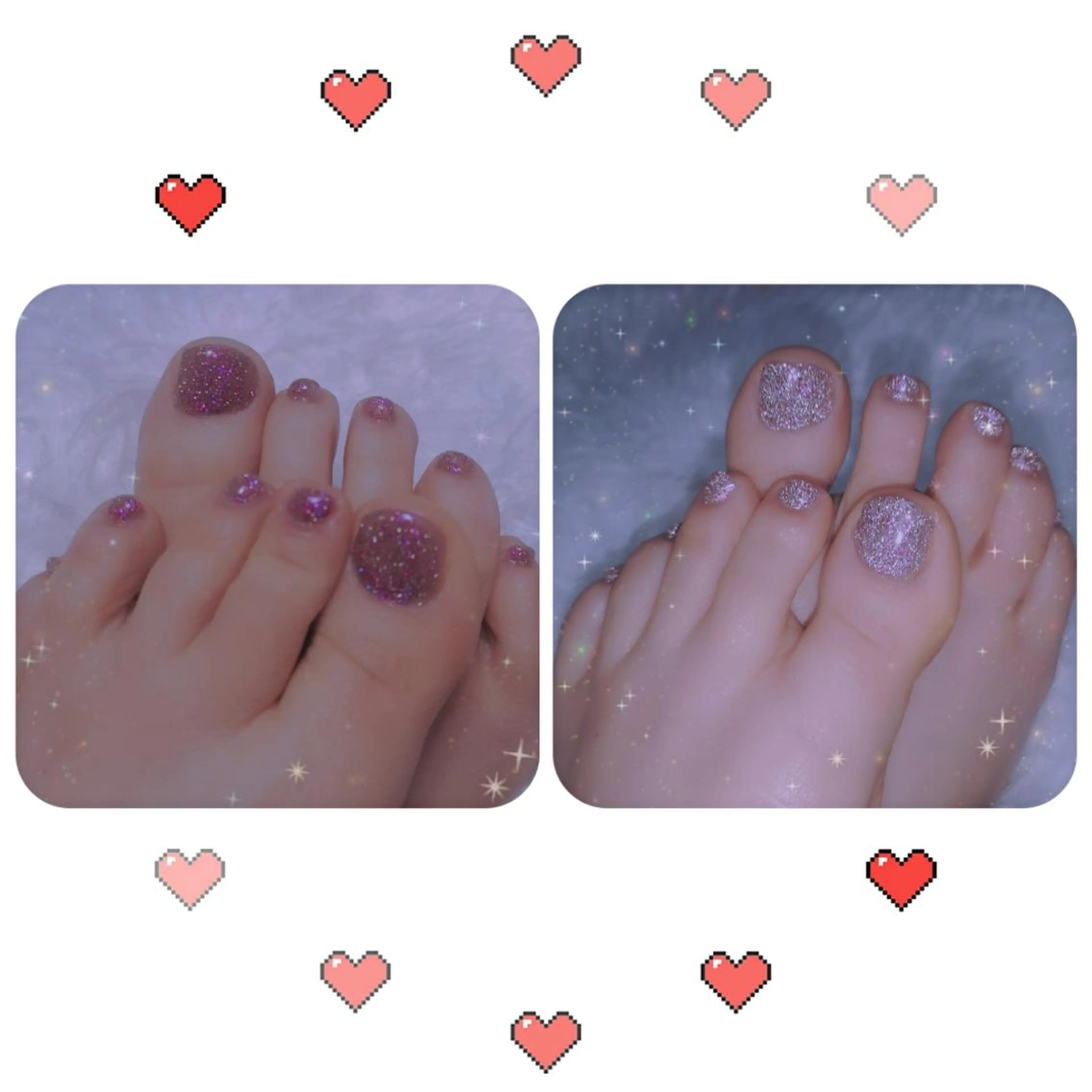 ネイル フラッシュネイル フットネイル ネイリストゆか💅 長さだし、深爪矯正のネイルデザイン