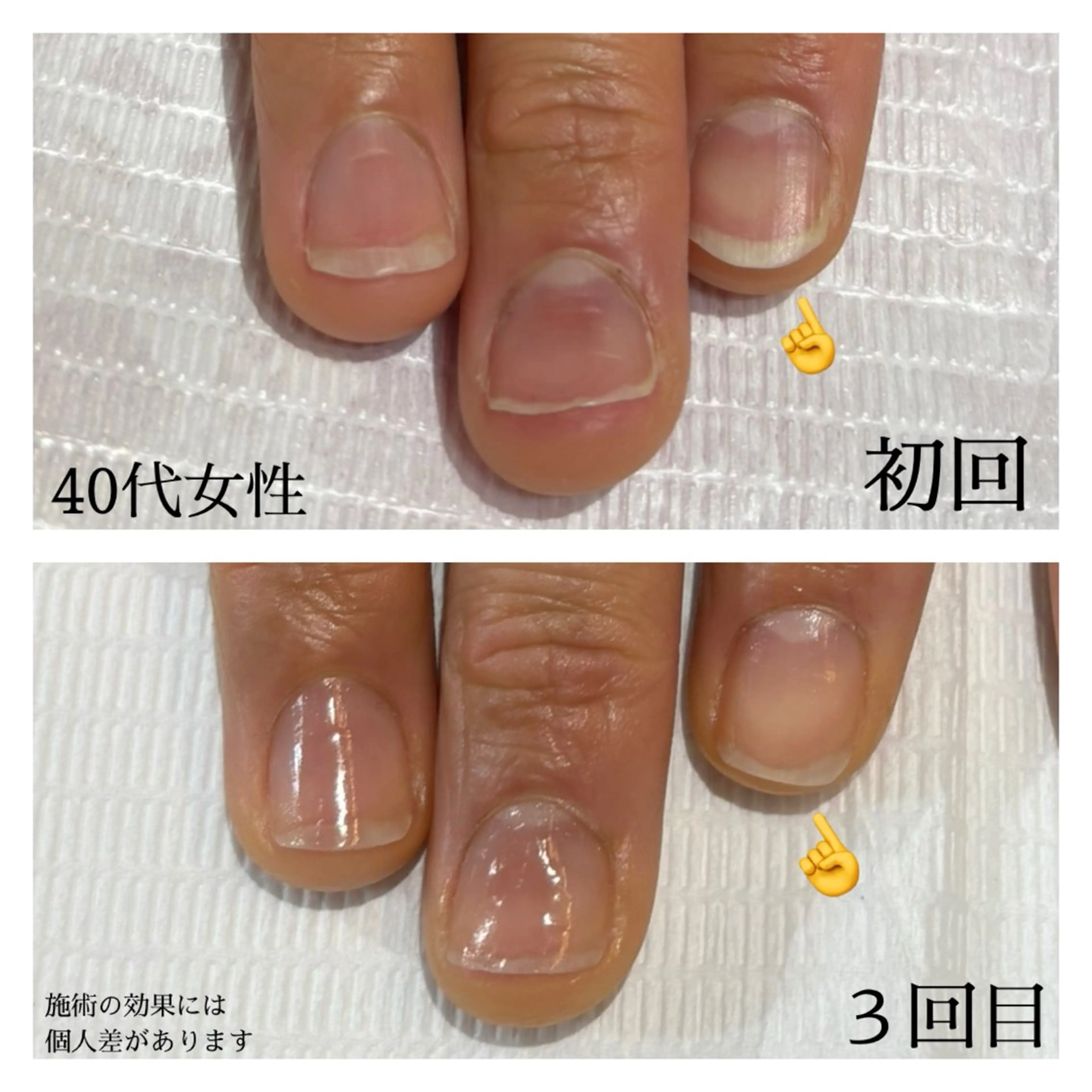 ネイル ピンク 自爪育成専門サロン エムロードゥ池下のネイルデザイン