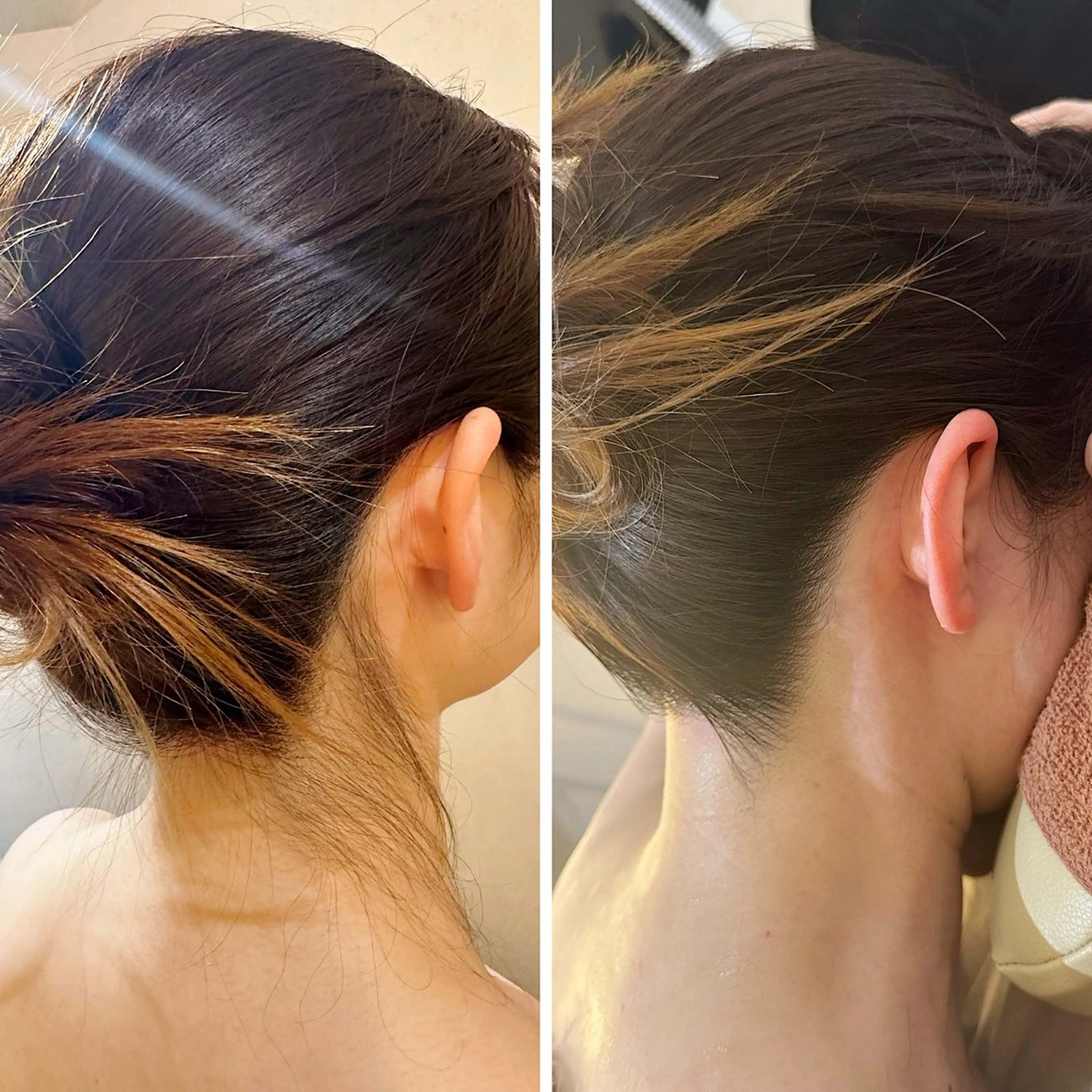 脱毛 うなじ脱毛/美肌脱毛 LABELのエステ・リラクイメージ