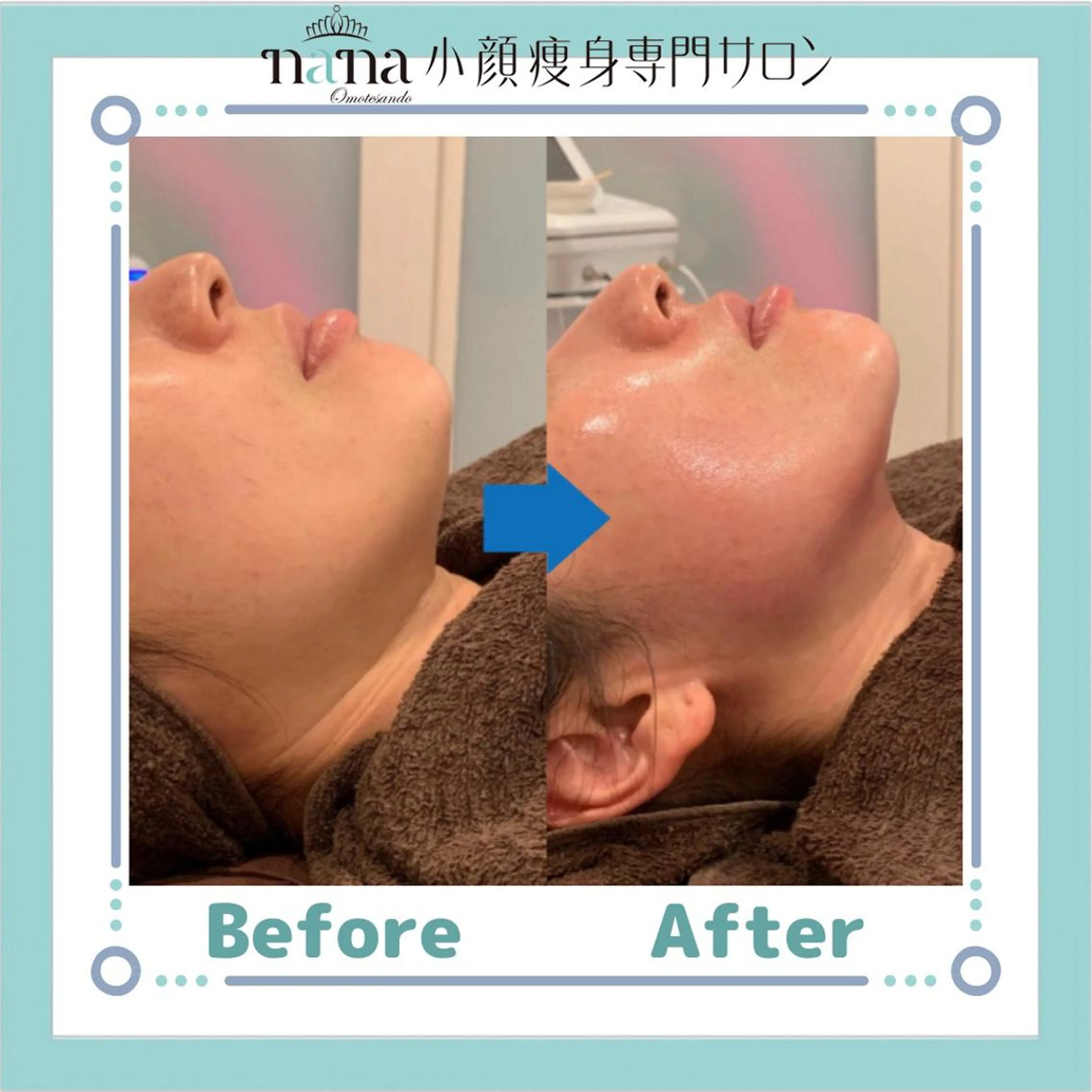 小顔痩身インディバ Nana表参道のエステ・リラクイメージ