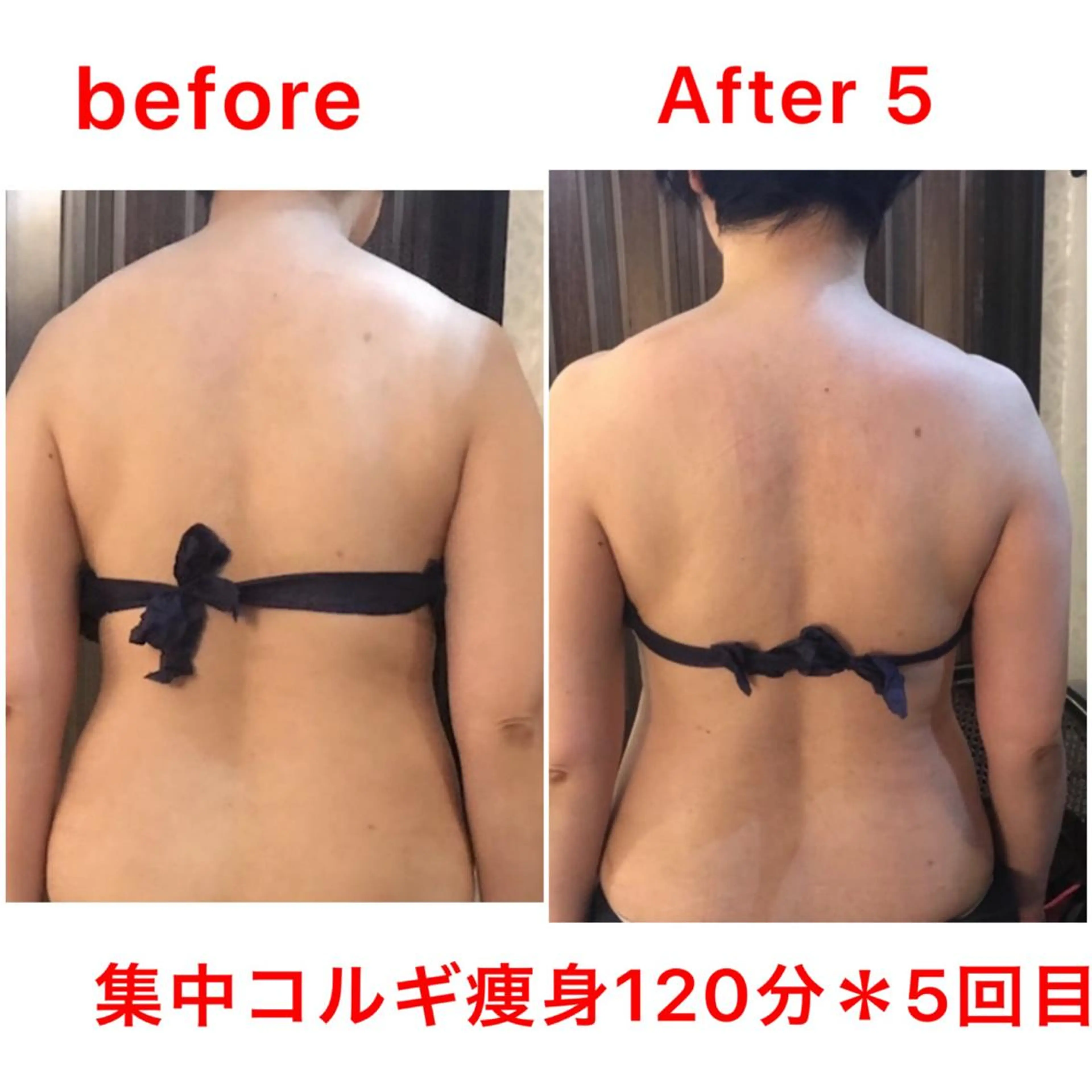 【ハイパーナイフ痩身&小顔コルギ&ハーブピーリング】K-Beauty　東新宿所属・kーbeauty痩身 フェイシャルのエステ・リラクイメージ